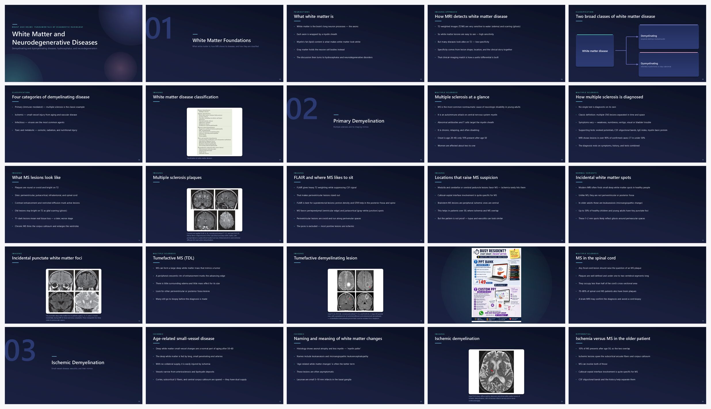 Preview of the first 25 slides of White Matter and Neurodegenerative Diseases