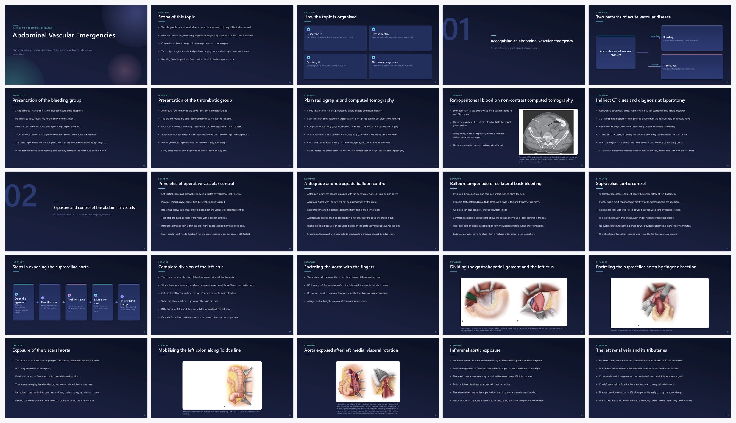 Preview of the first 25 slides of Abdominal Vascular Emergencies