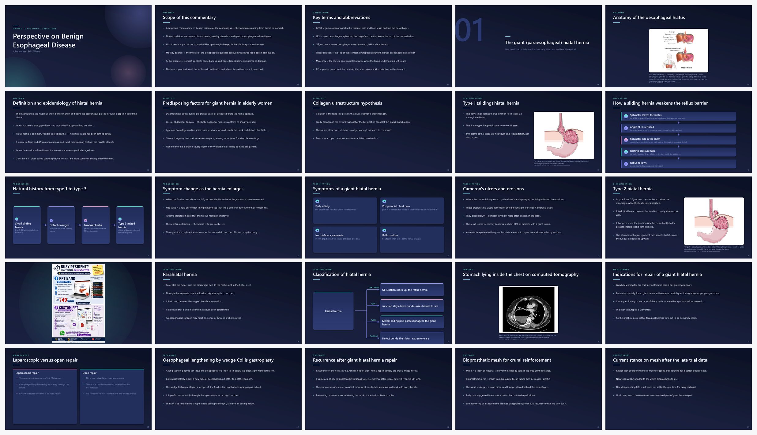 Preview of the first 25 slides of Perspective on Benign Esophageal Disease