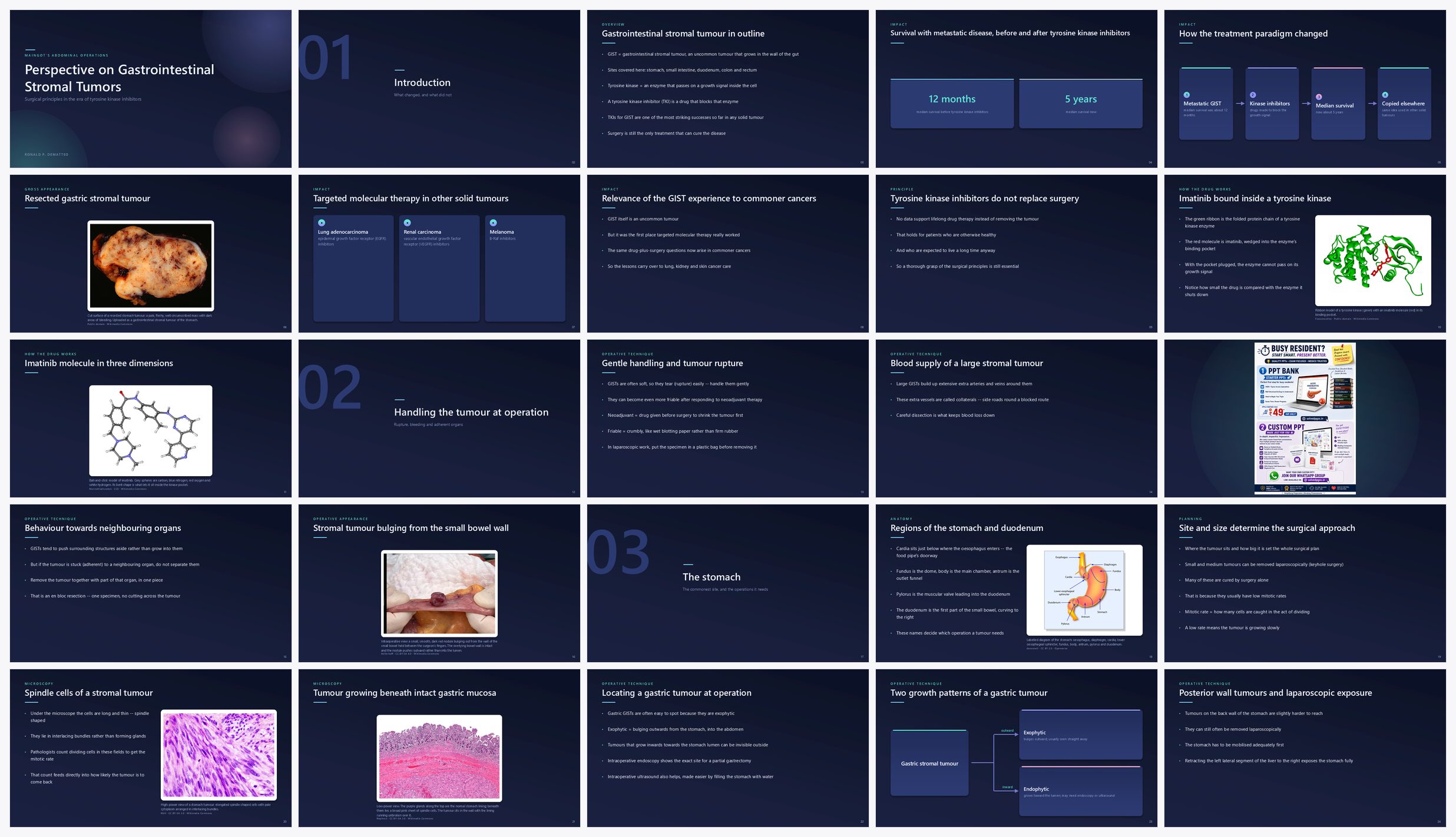 Preview of the first 25 slides of Perspective on Gastrointestinal Stromal Tumors