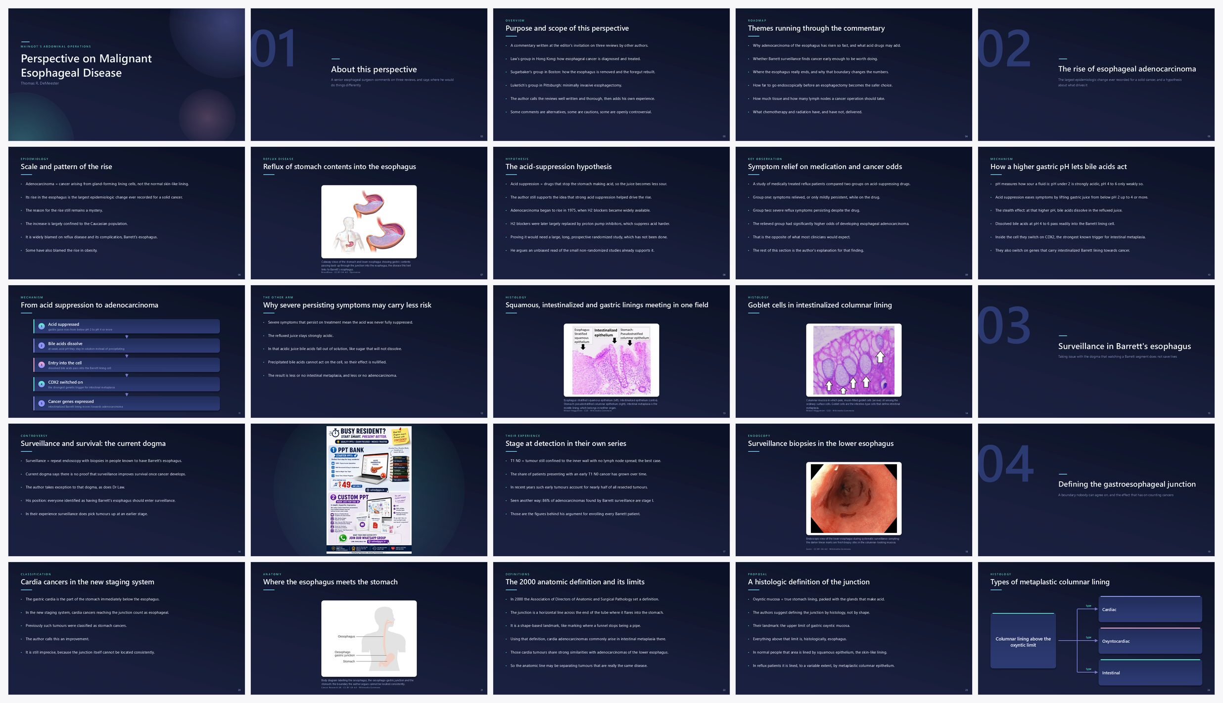 Preview of the first 25 slides of Perspective on Malignant Esophageal Disease (A)