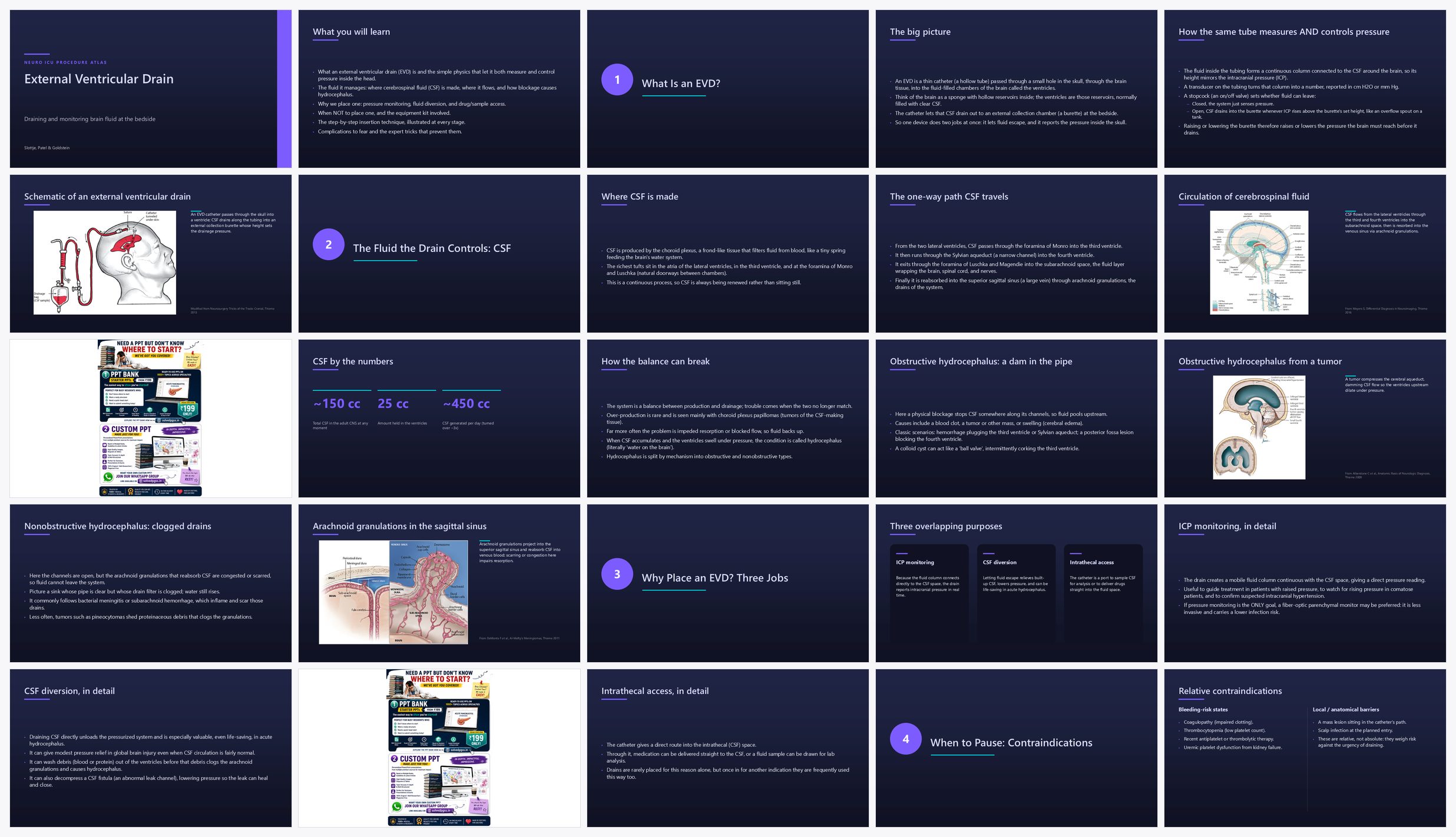 Preview of the first 25 slides of 1 External Ventricular Drain