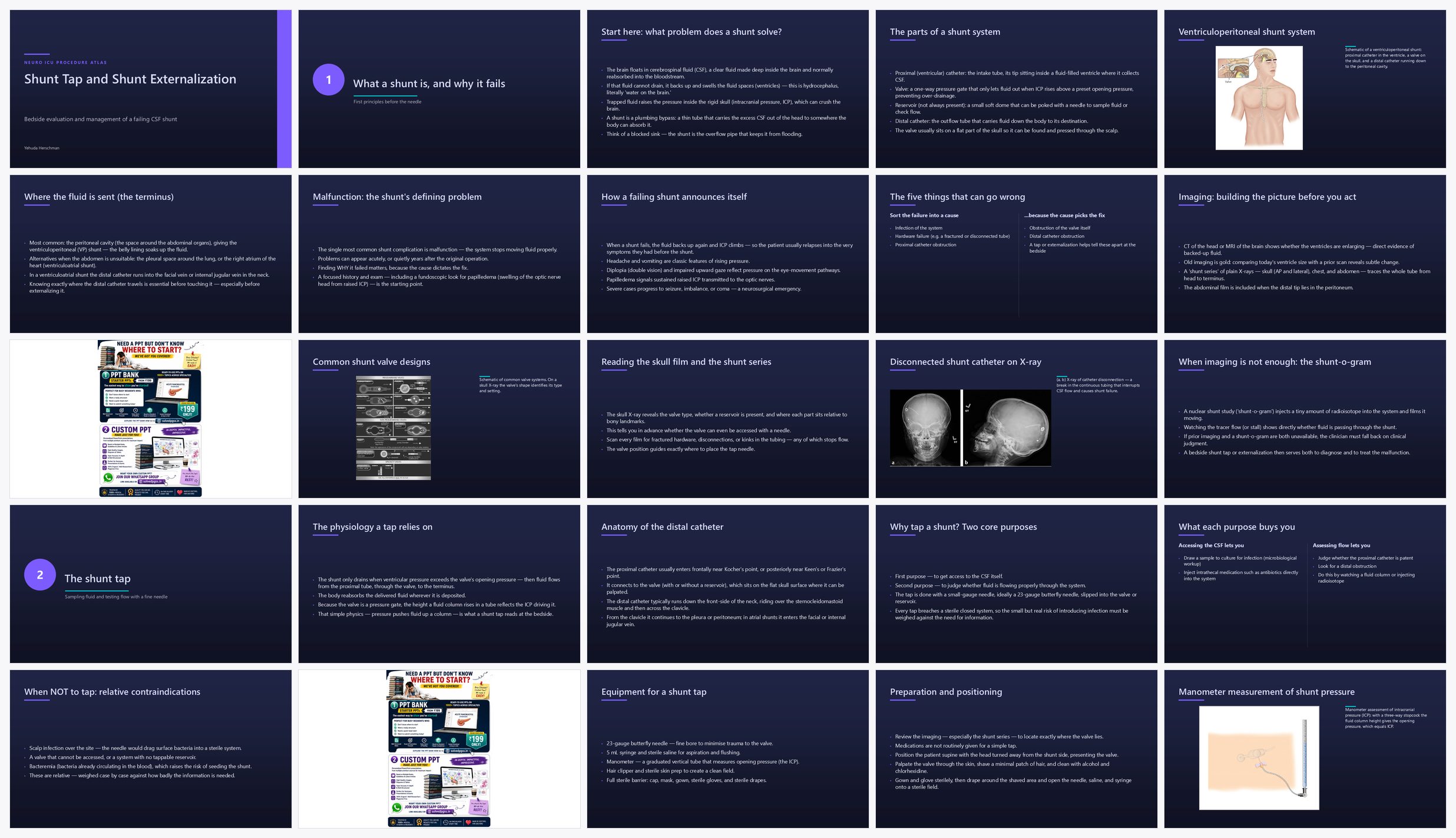 Preview of the first 25 slides of 2 Shunt Tap and Shunt Externalization