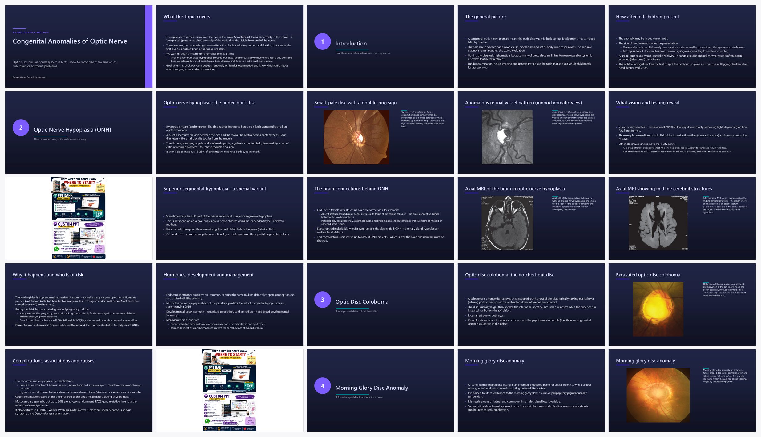 Preview of the first 25 slides of Congenital Anomalies of Optic Nerve