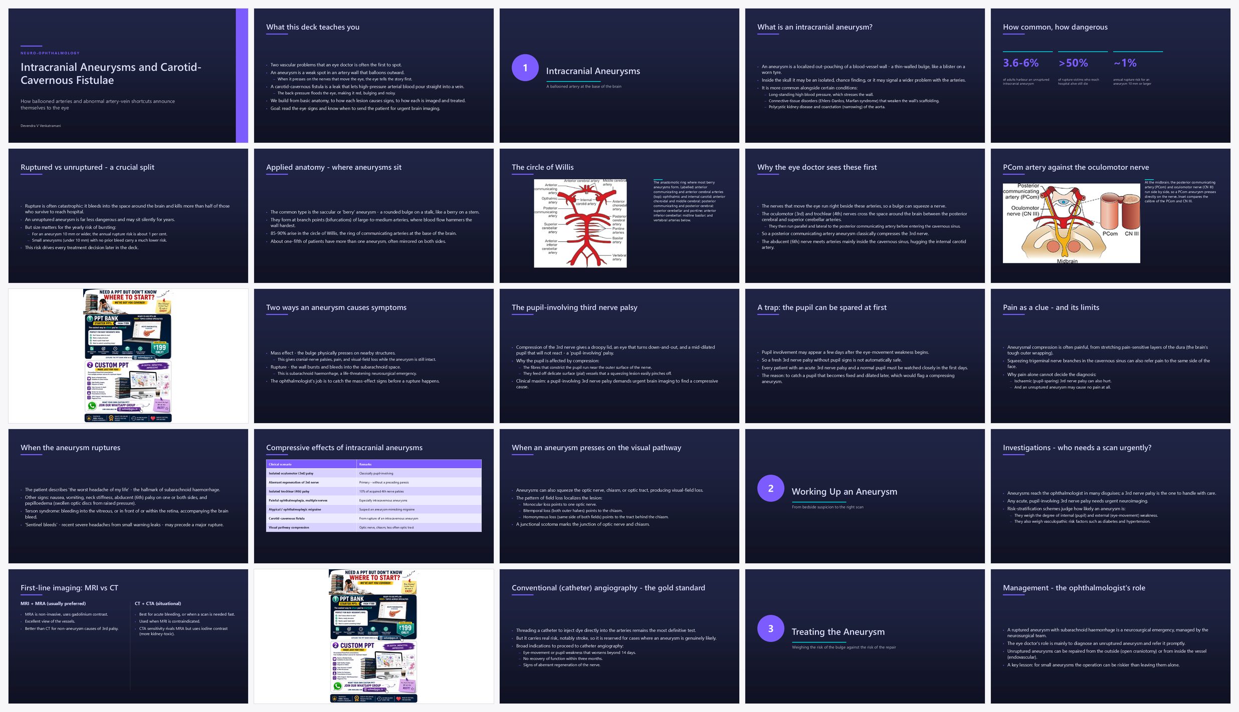 Preview of the first 25 slides of Intracranial Aneurysms and Carotid Cavernous Fistulae