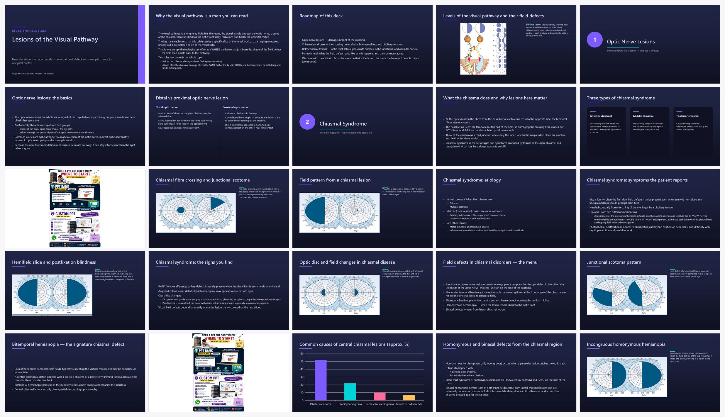 Preview of the first 25 slides of Lesions of the Visual Pathway