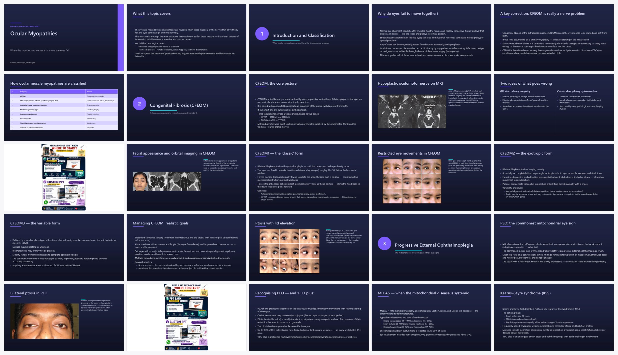 Preview of the first 25 slides of Ocular Myopathies