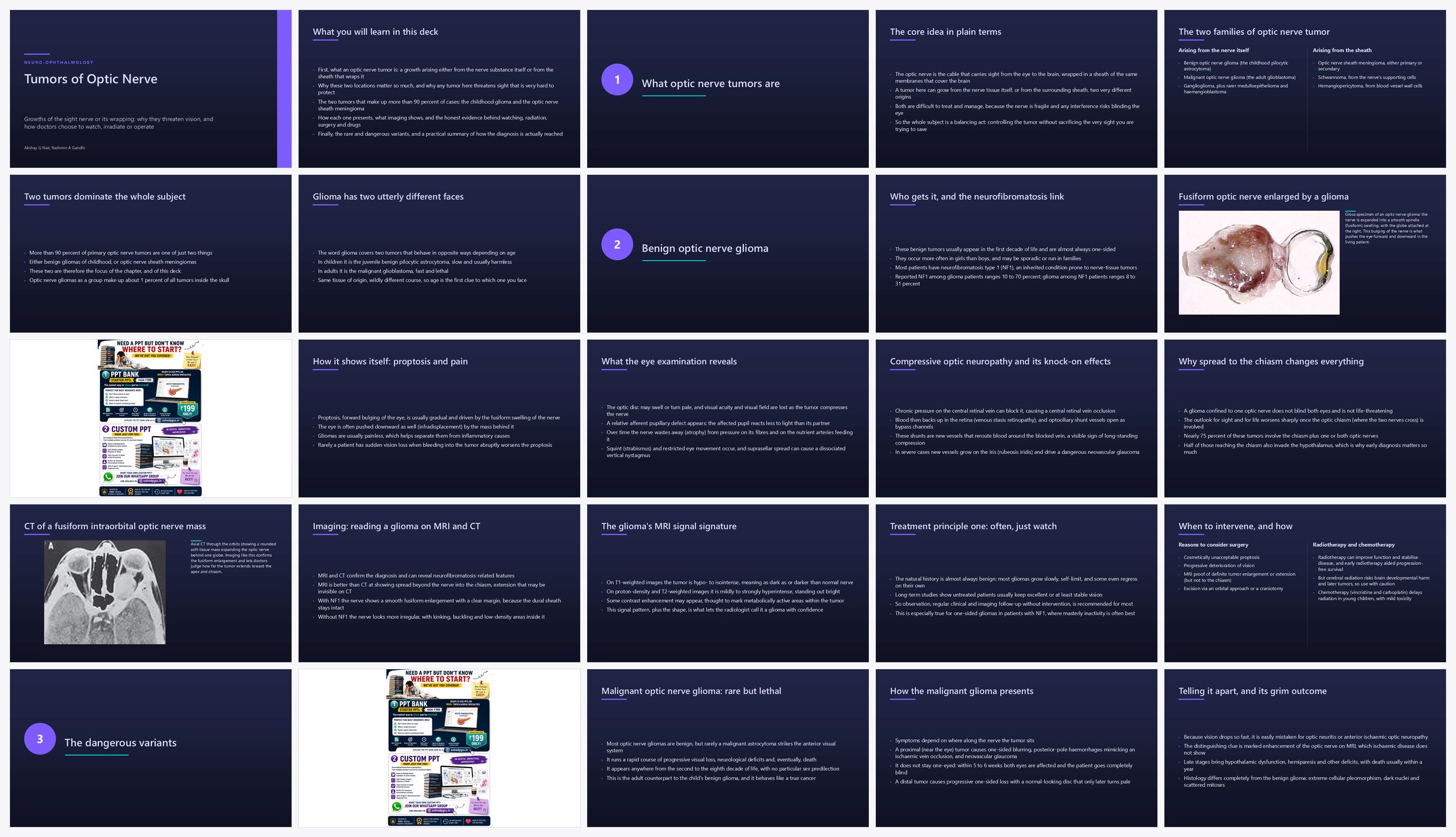 Preview of the first 25 slides of Tumors of Optic Nerve