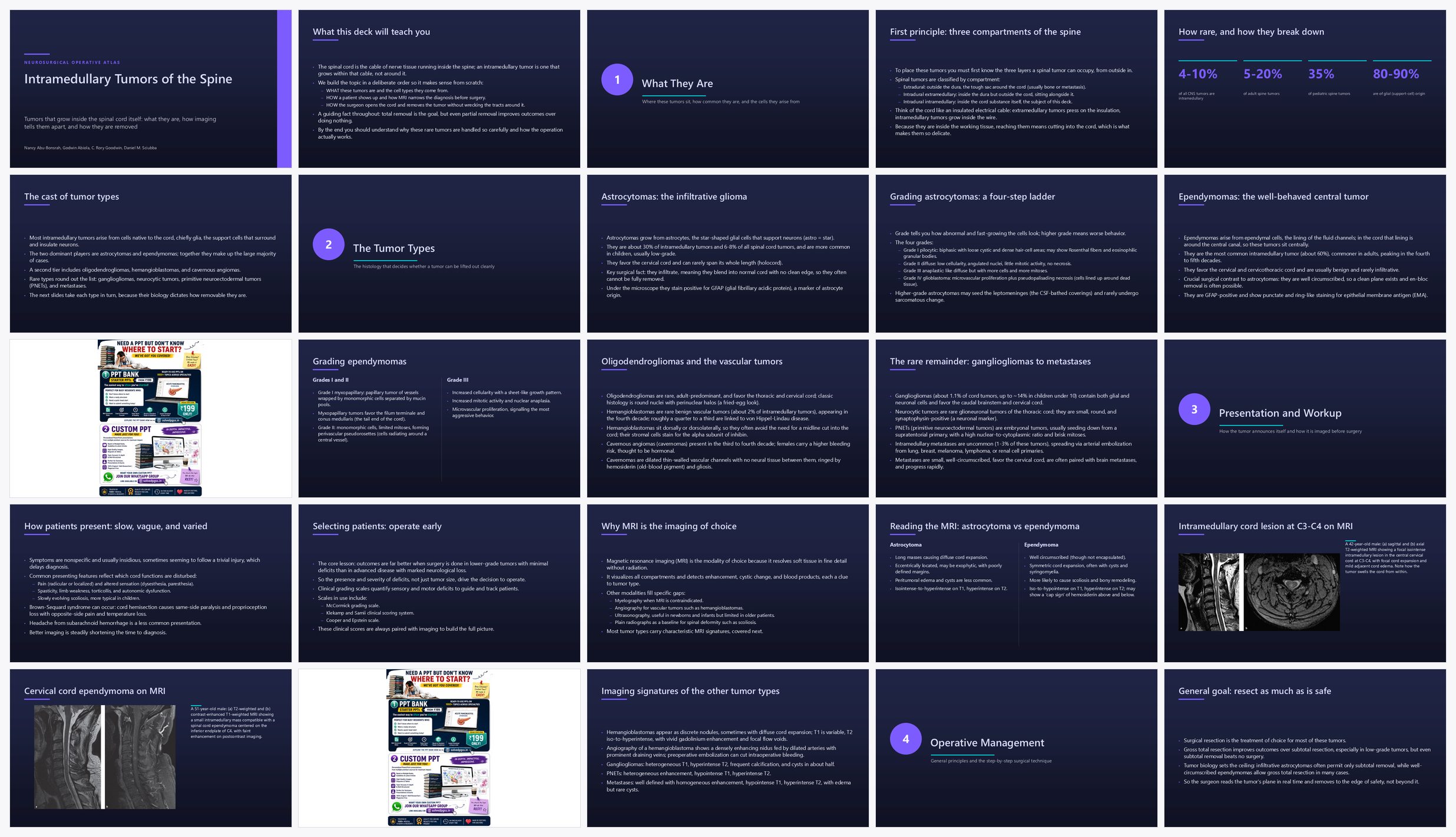Preview of the first 25 slides of Intramedullary Tumors of the Spine