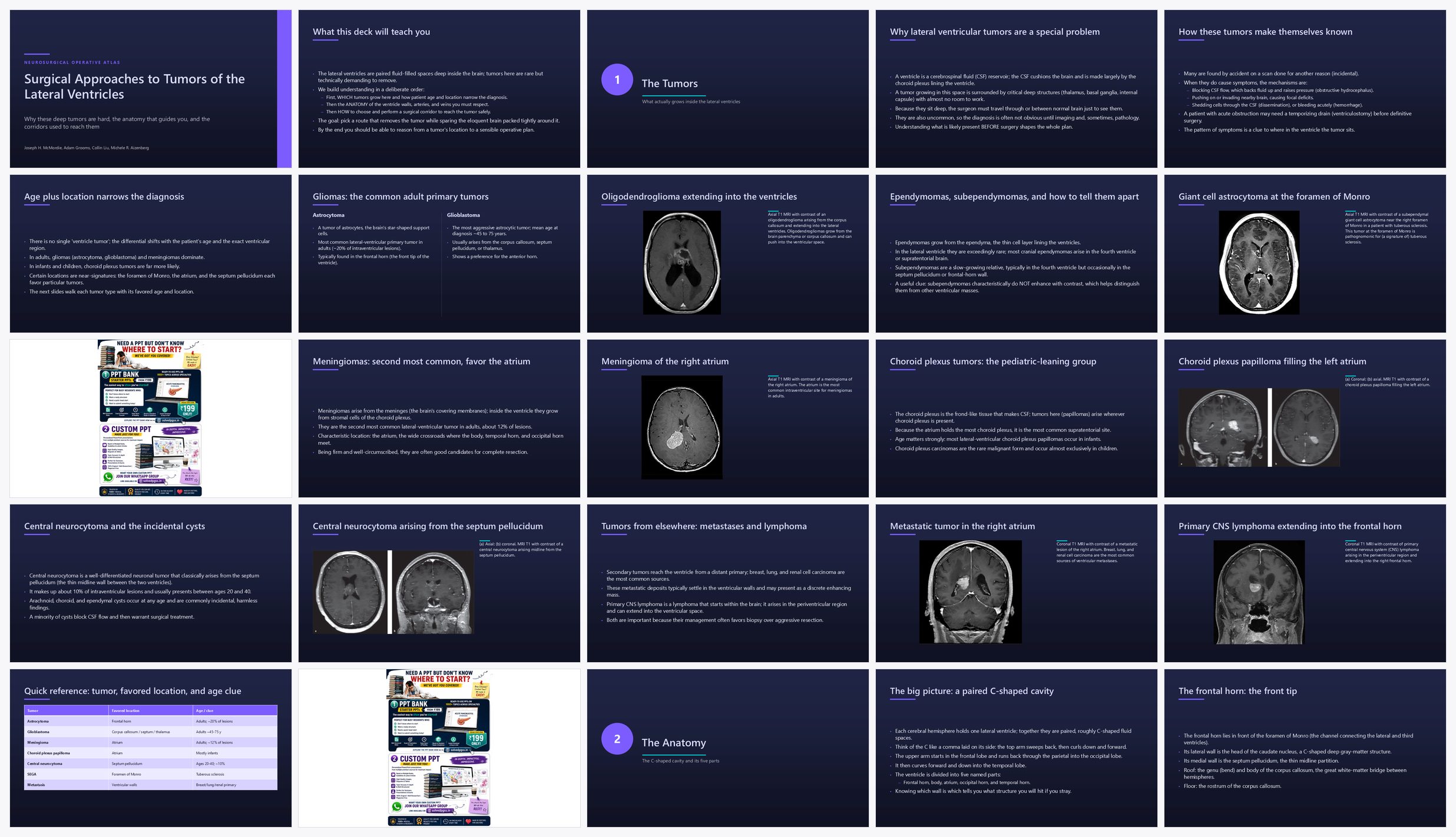 Preview of the first 25 slides of Surgical Approaches to Intraventricular Tumors Lateral Ven