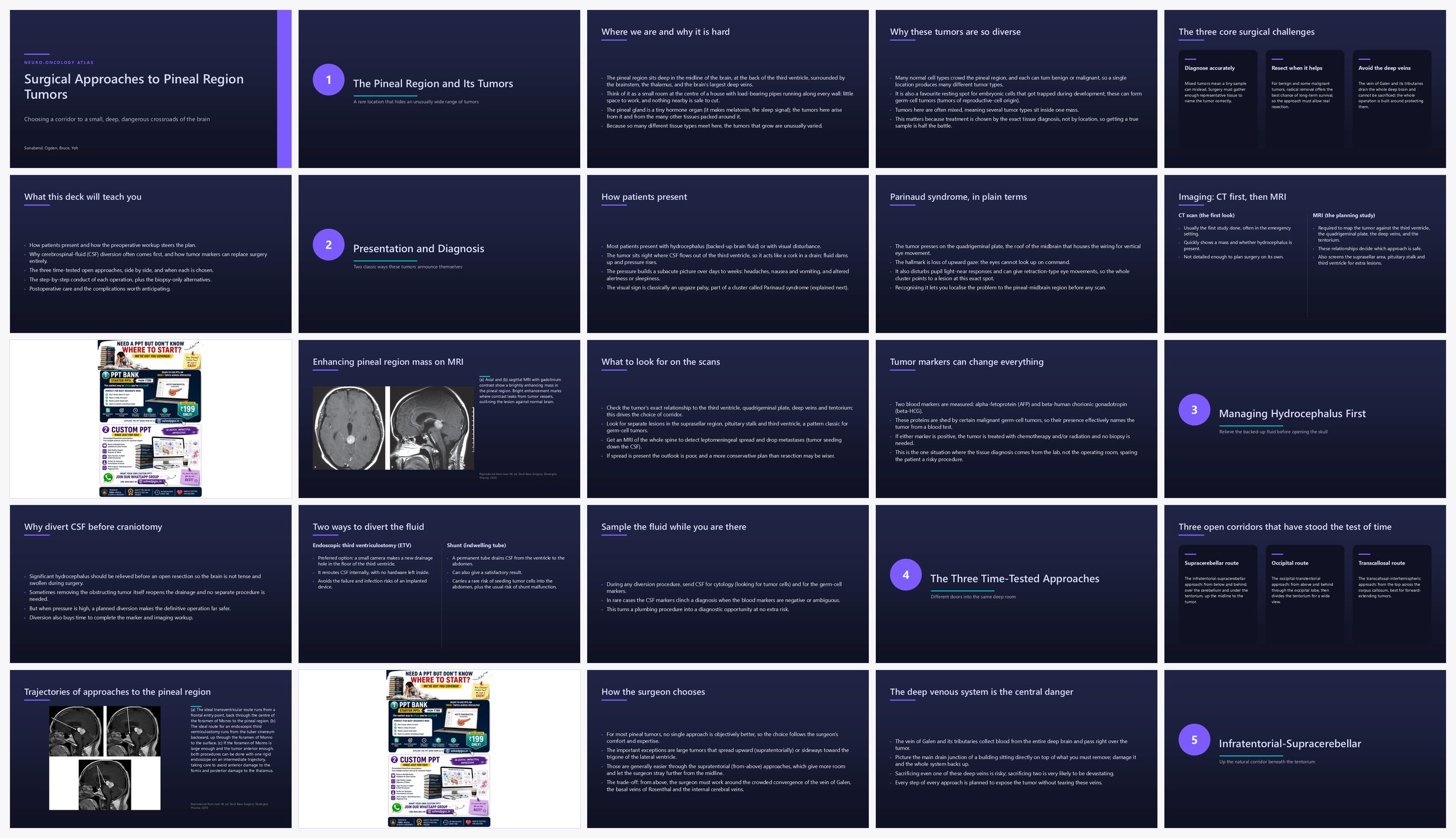 Preview of the first 25 slides of Surgical Approaches to Pineal Region Tumors