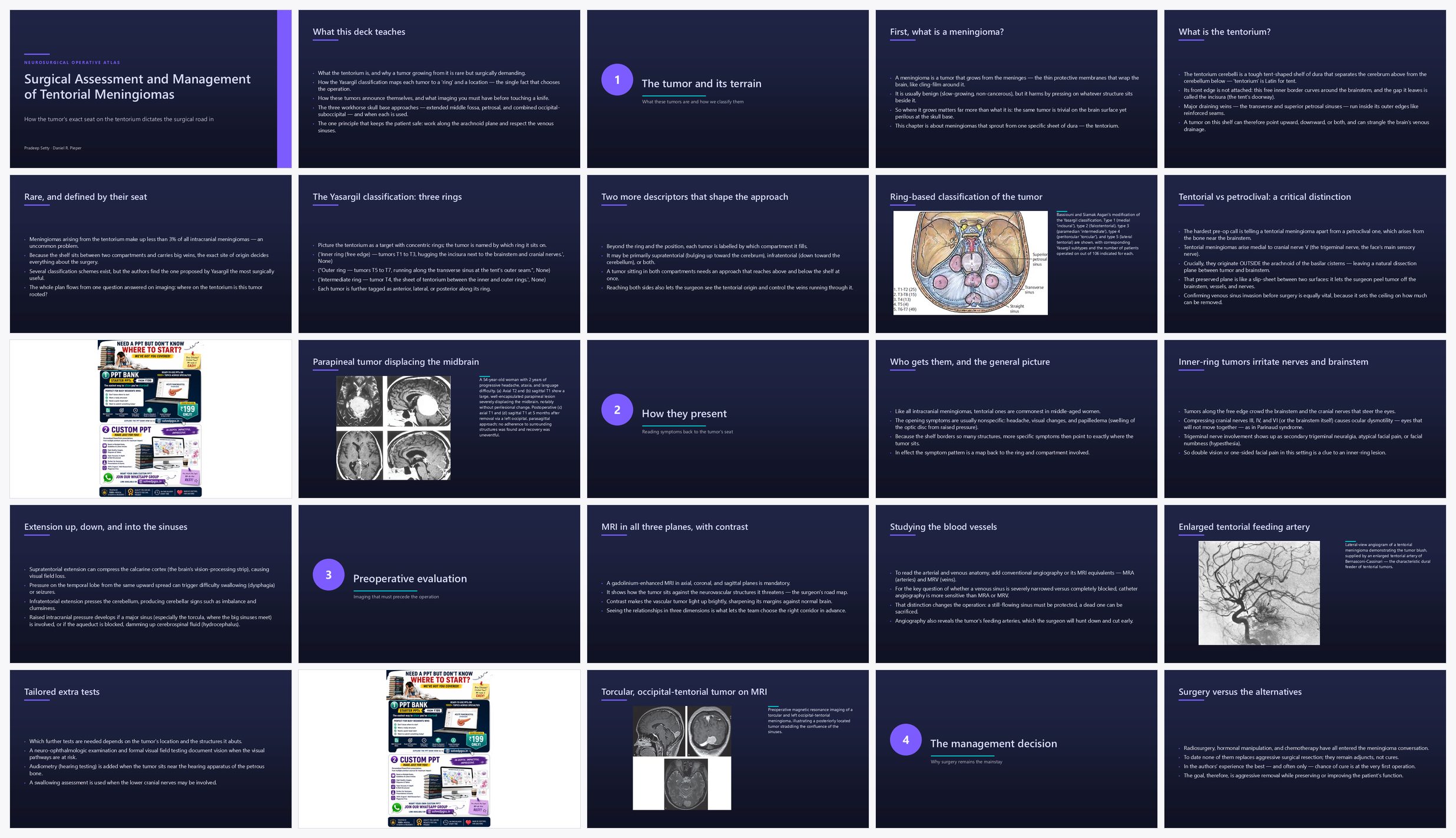 Preview of the first 25 slides of Surgical Assessment and Management of Tentorial Meningioma