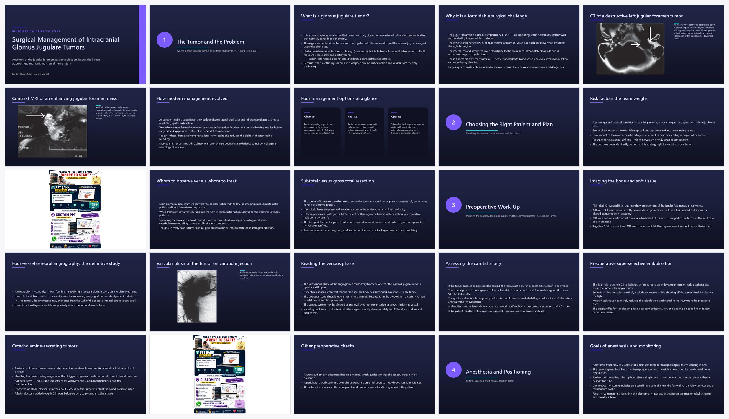 Preview of the first 25 slides of Surgical Management of Intracranial Glomus Jugulare Tumors