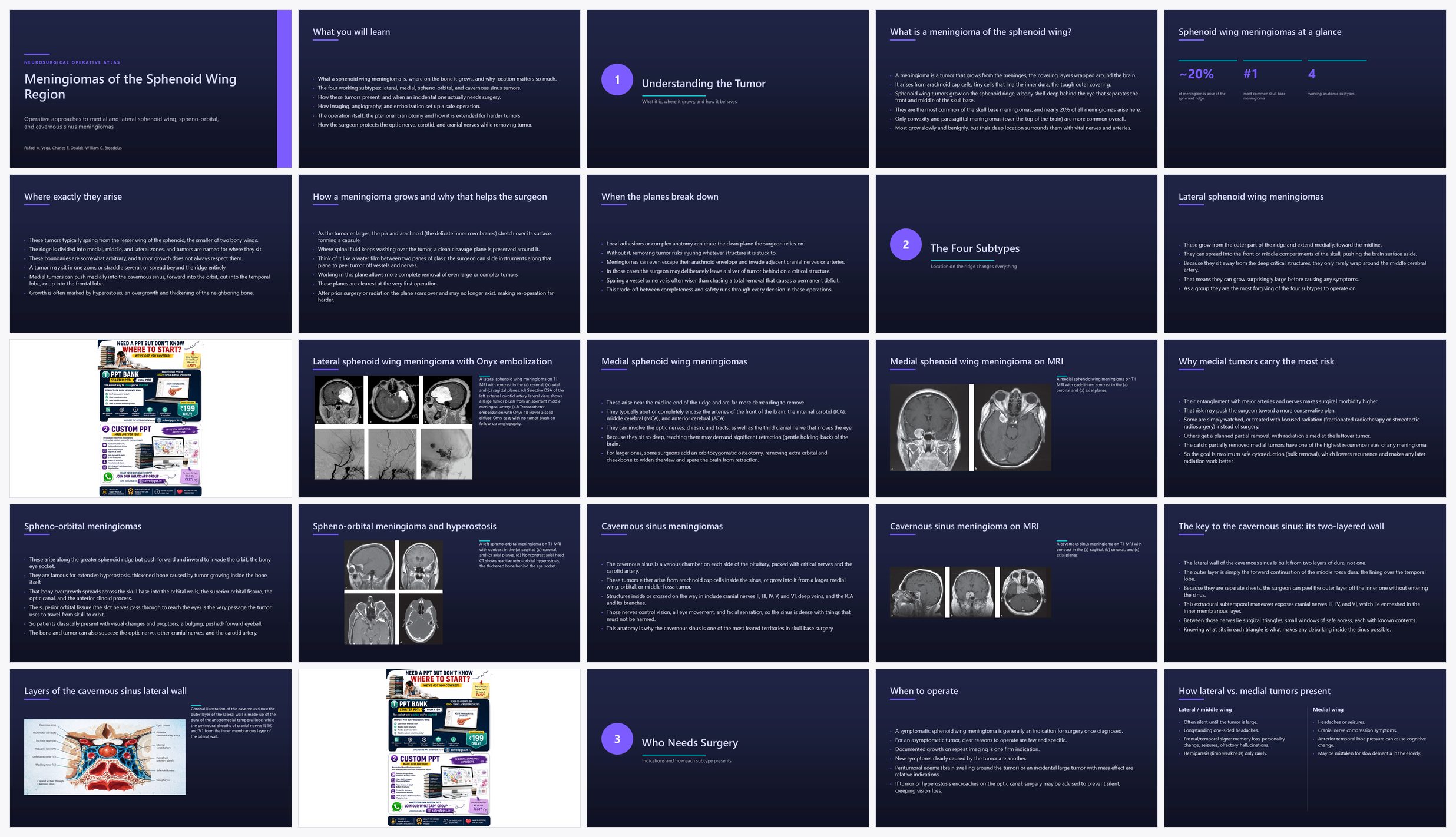 Preview of the first 25 slides of Surgical Management of Meningiomas of the Sphenoid Wing Re