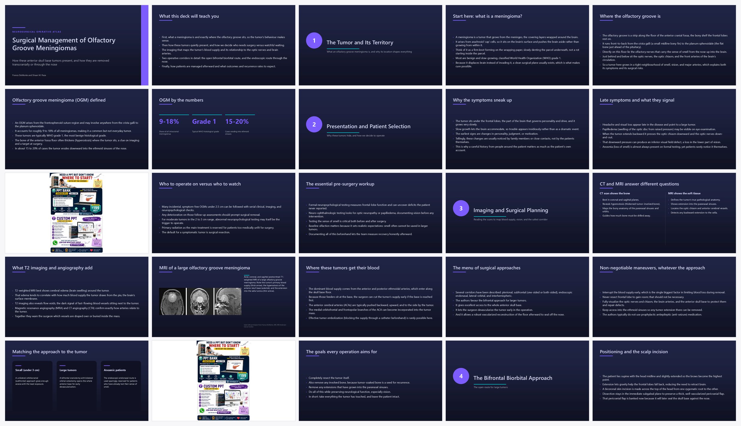 Preview of the first 25 slides of Surgical Management of Olfactory Groove Meningiomas