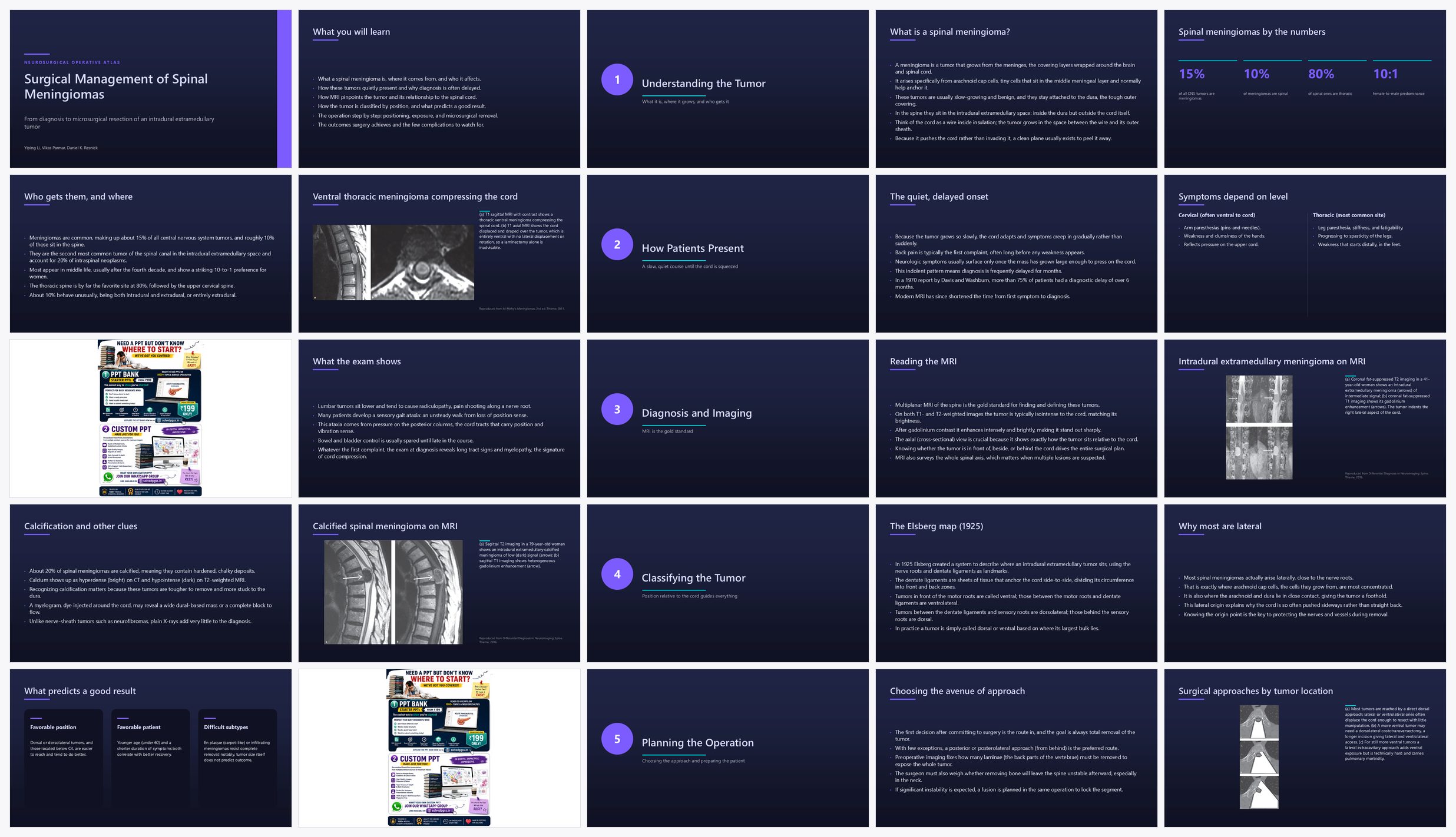 Preview of the first 25 slides of Surgical Management of Spinal Meningiomas