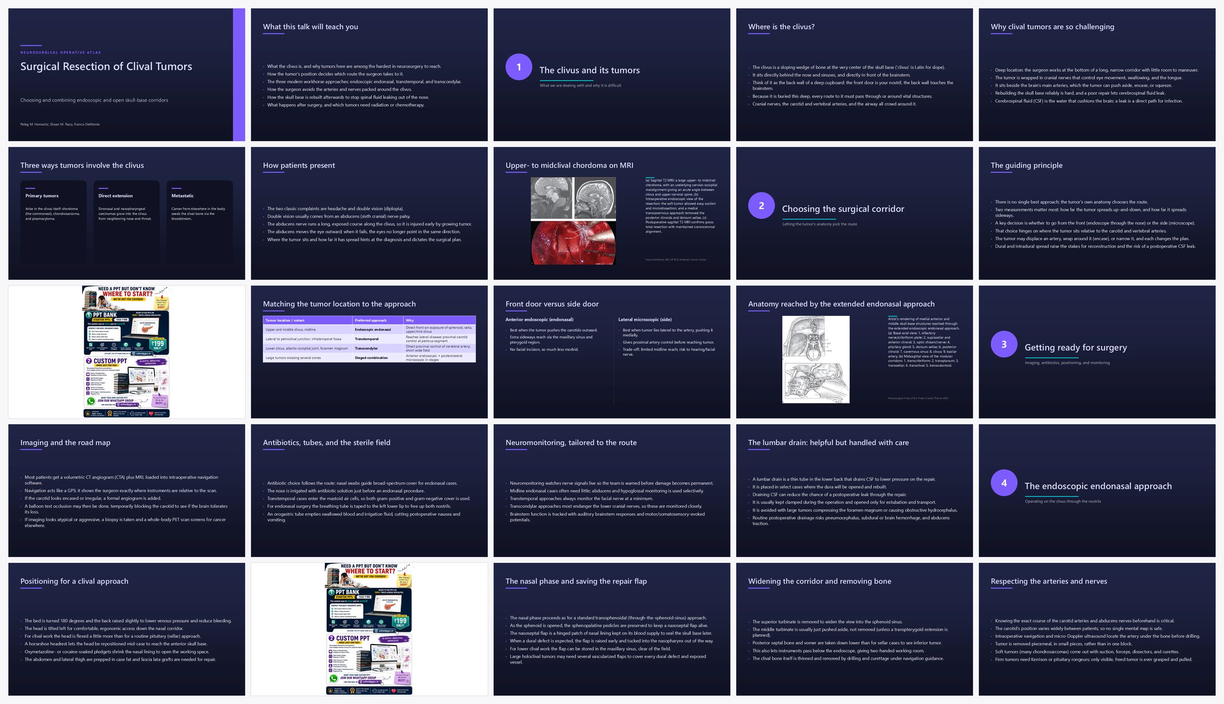 Preview of the first 25 slides of Surgical Resection of Clival Tumors