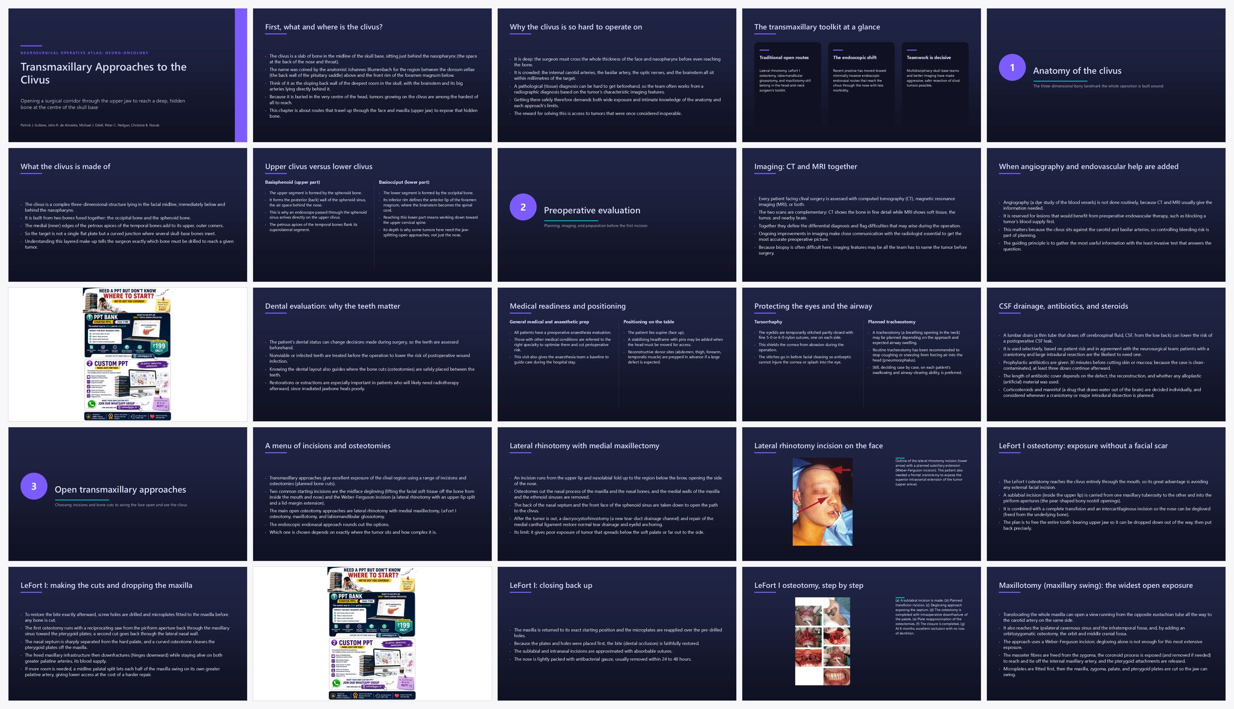 Preview of the first 25 slides of Transmaxillary Approaches to the Clivus