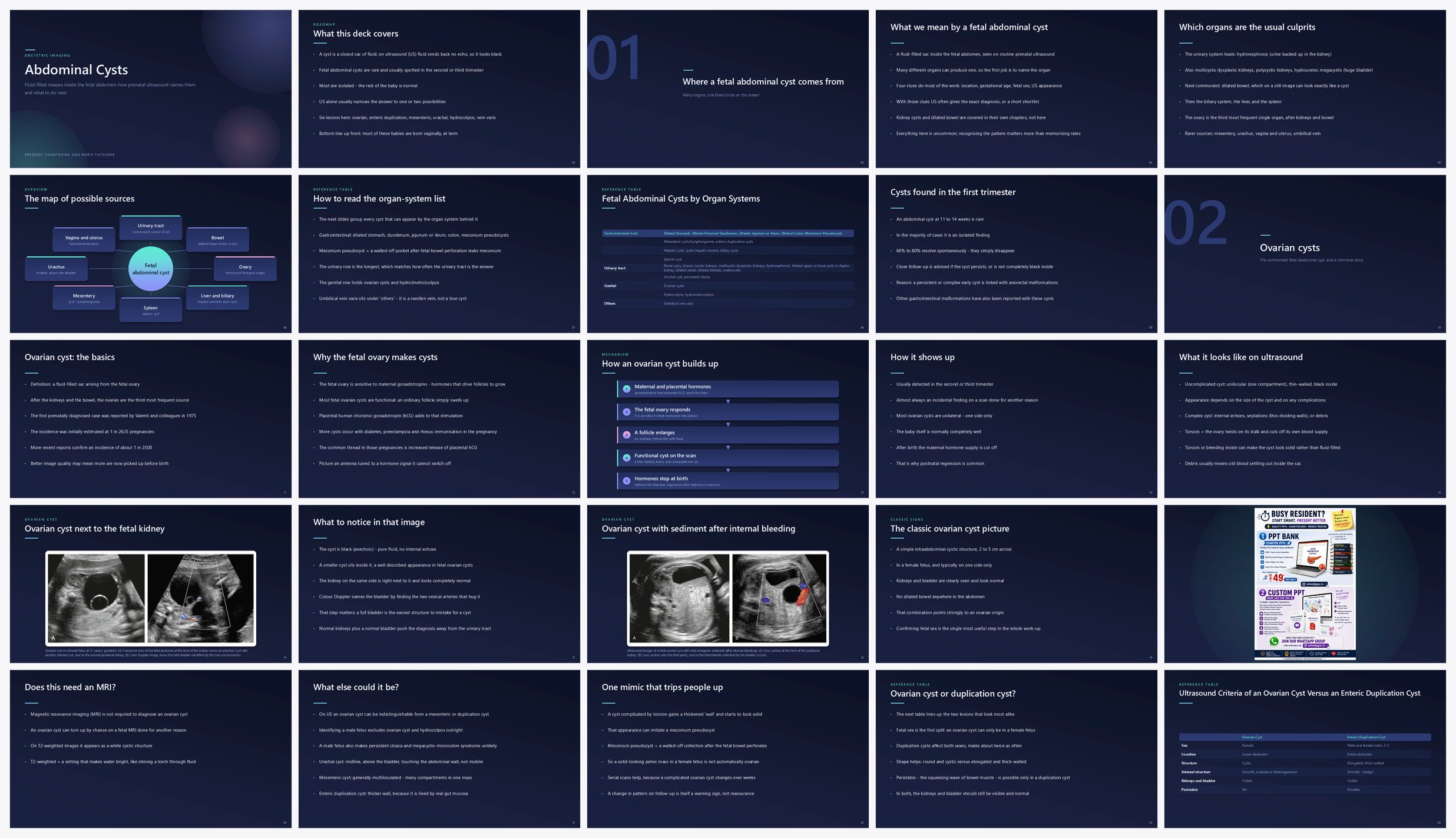 Preview of the first 25 slides of Abdominal Cysts