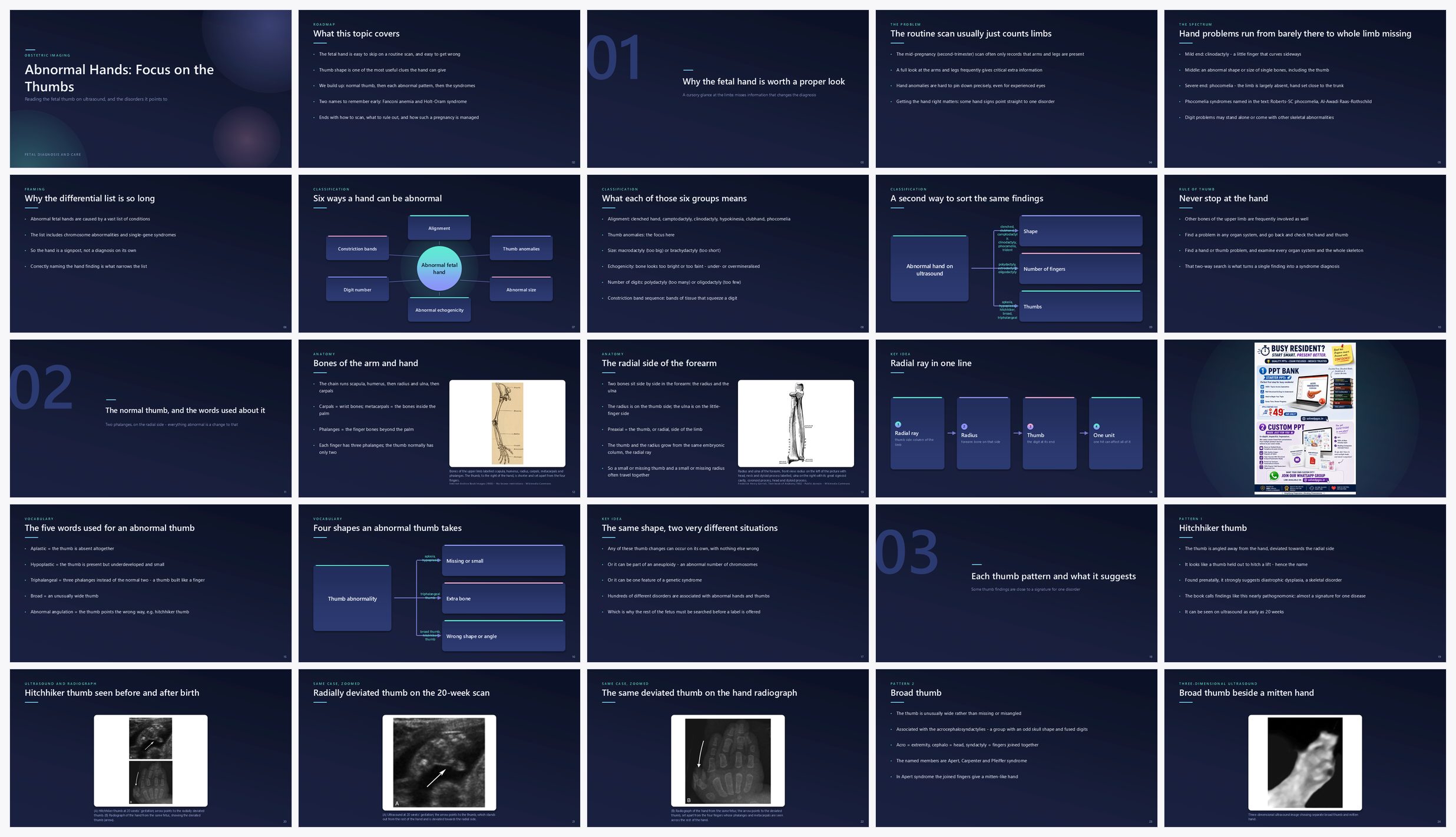 Preview of the first 25 slides of Abnormal Hands Focus on the Thumbs