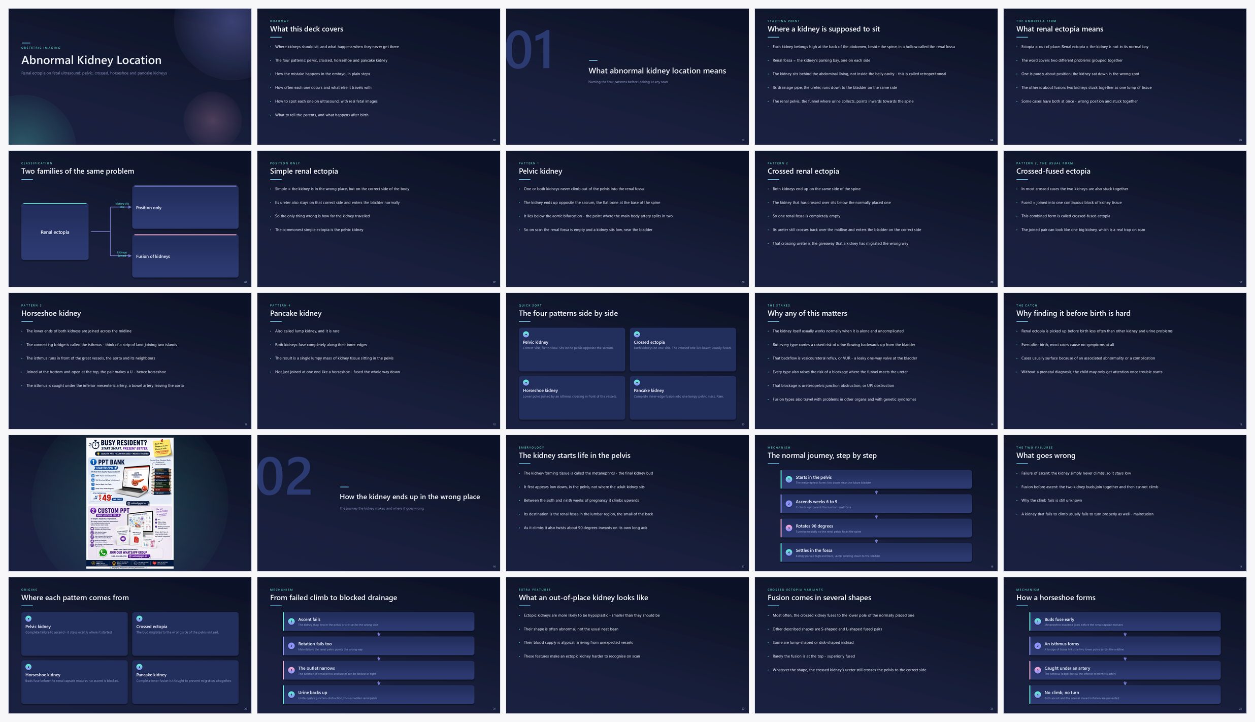 Preview of the first 25 slides of Abnormal Kidney Location