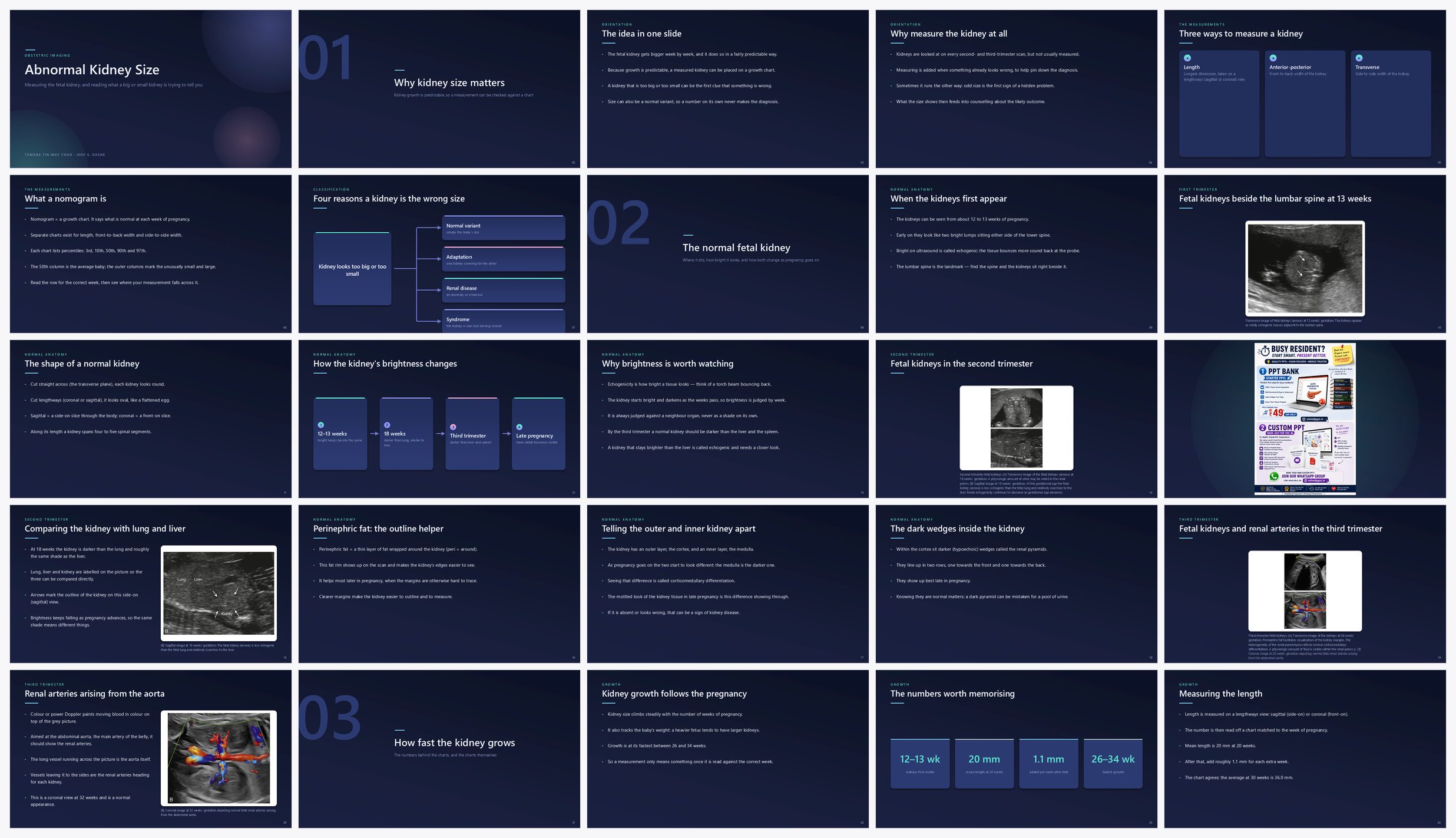 Preview of the first 25 slides of Abnormal Kidney Size