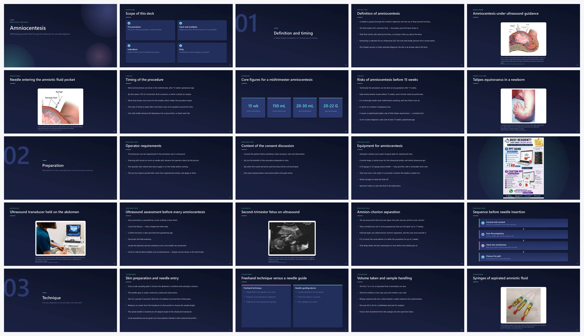 Preview of the first 25 slides of Amniocentesis