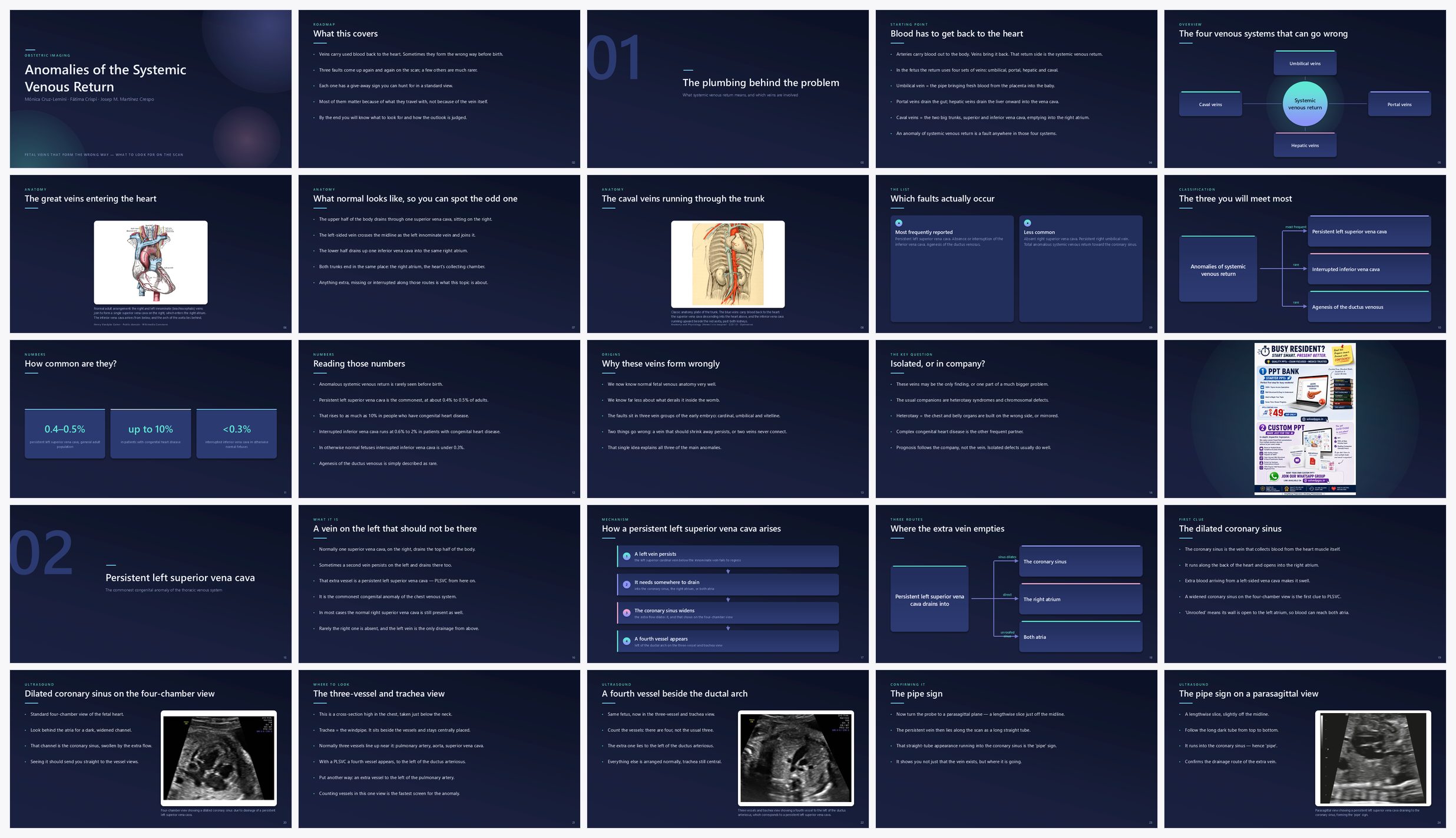 Preview of the first 25 slides of Anomalies of the Systemic Venous Return