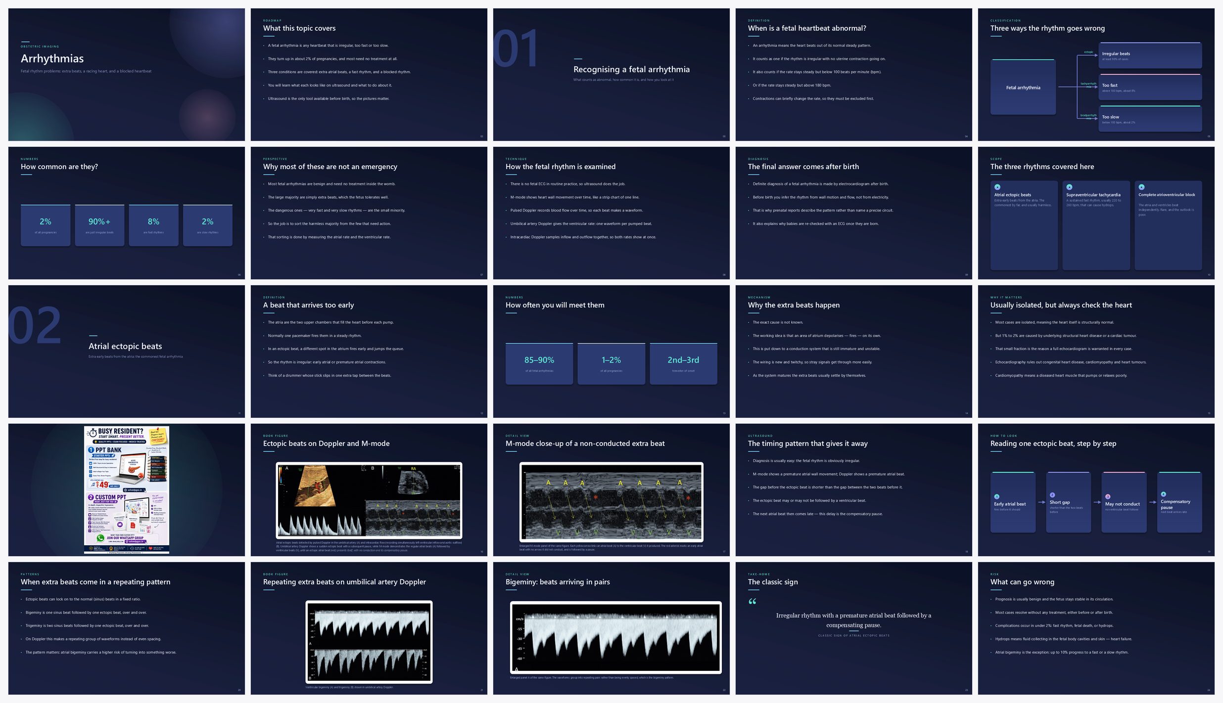 Preview of the first 25 slides of Arrhythmias