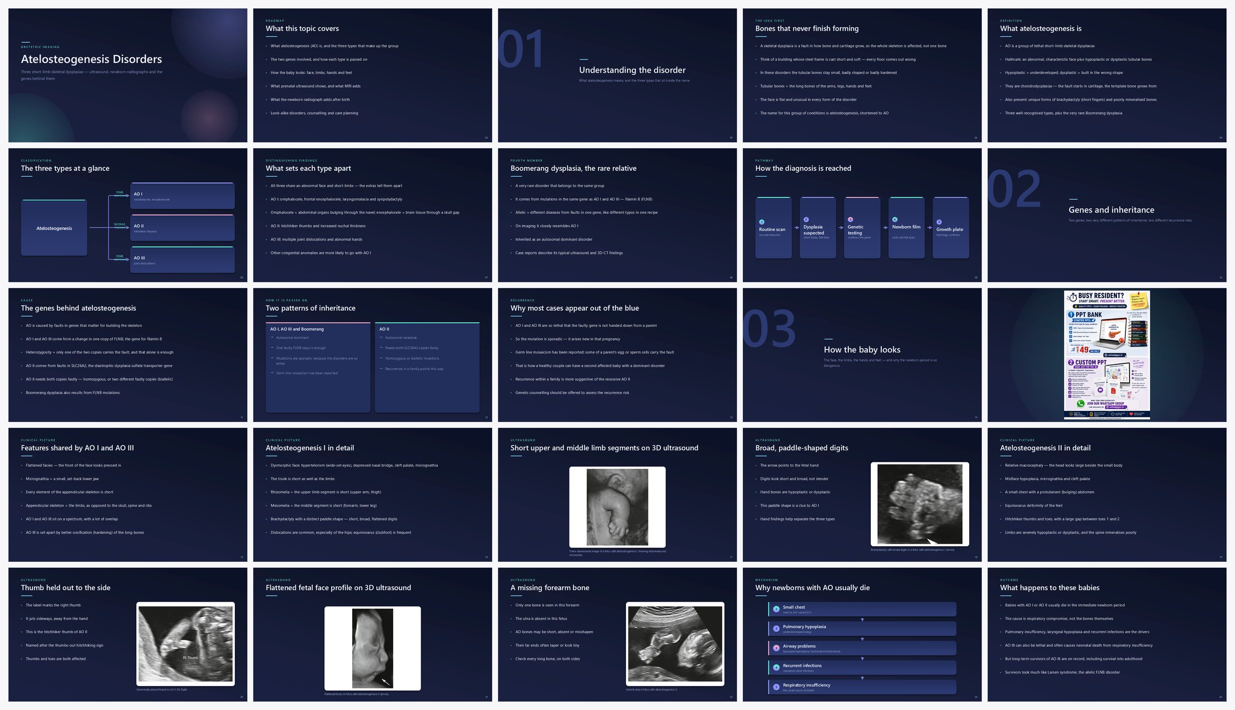 Preview of the first 25 slides of Atelosteogenesis Disorders