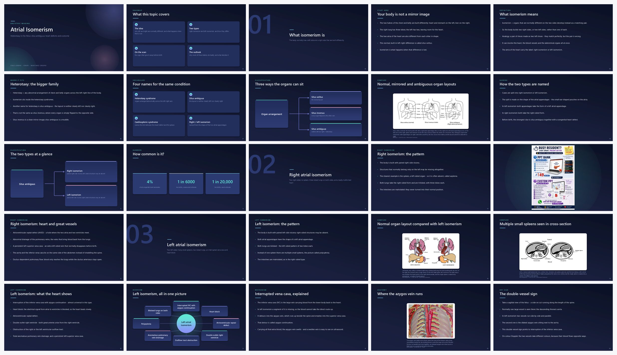 Preview of the first 25 slides of Atrial Isomerism