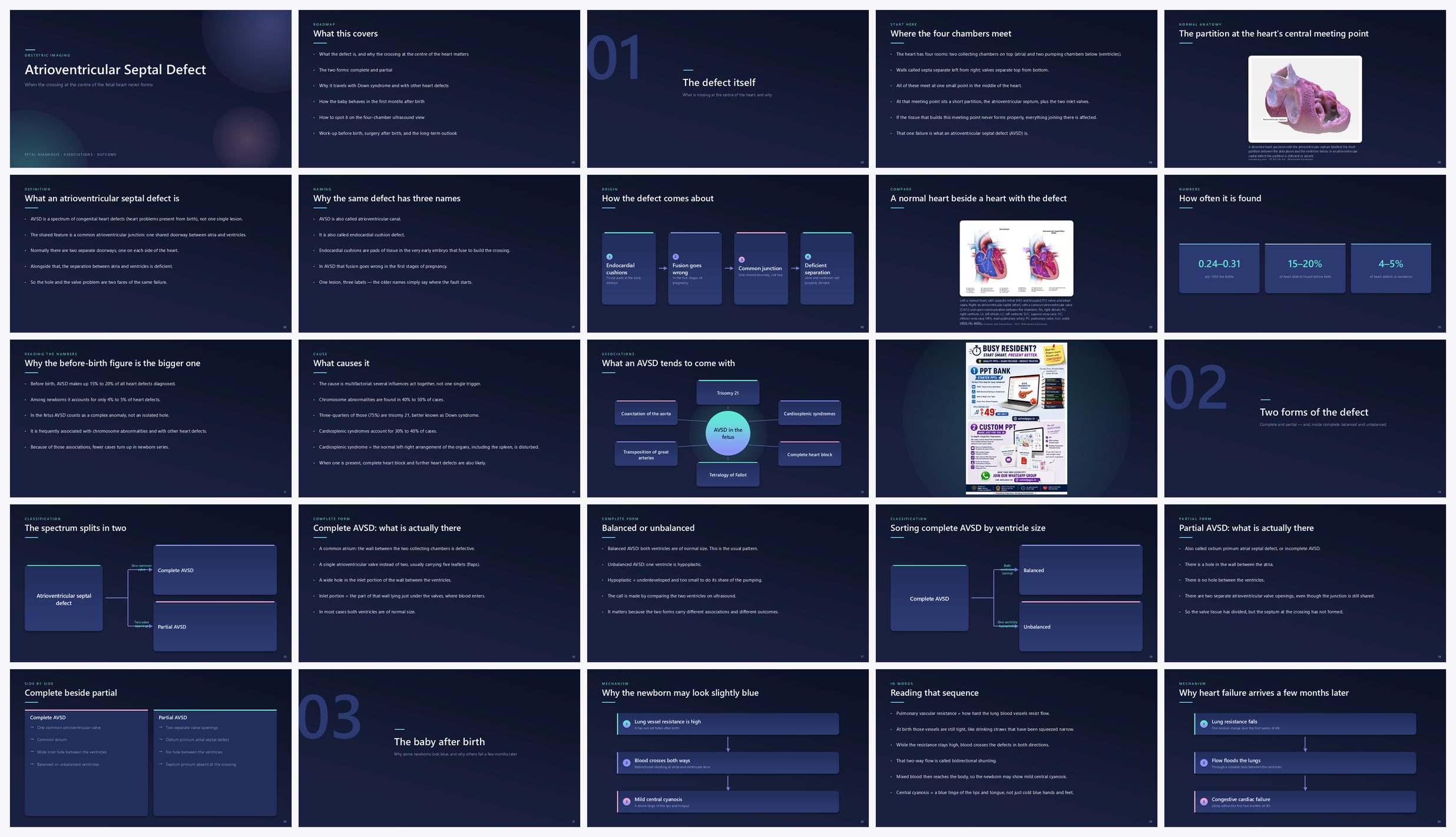Preview of the first 25 slides of Atrioventricular Septal Defect