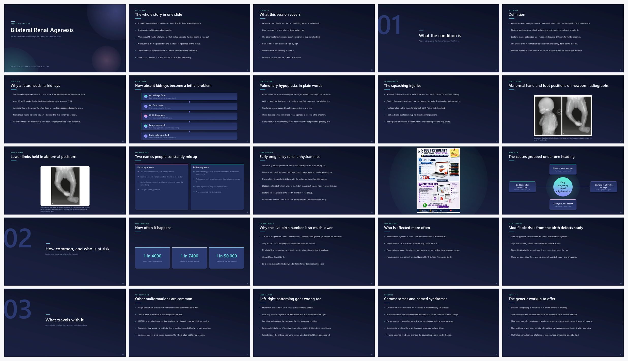 Preview of the first 25 slides of Bilateral Renal Agenesis