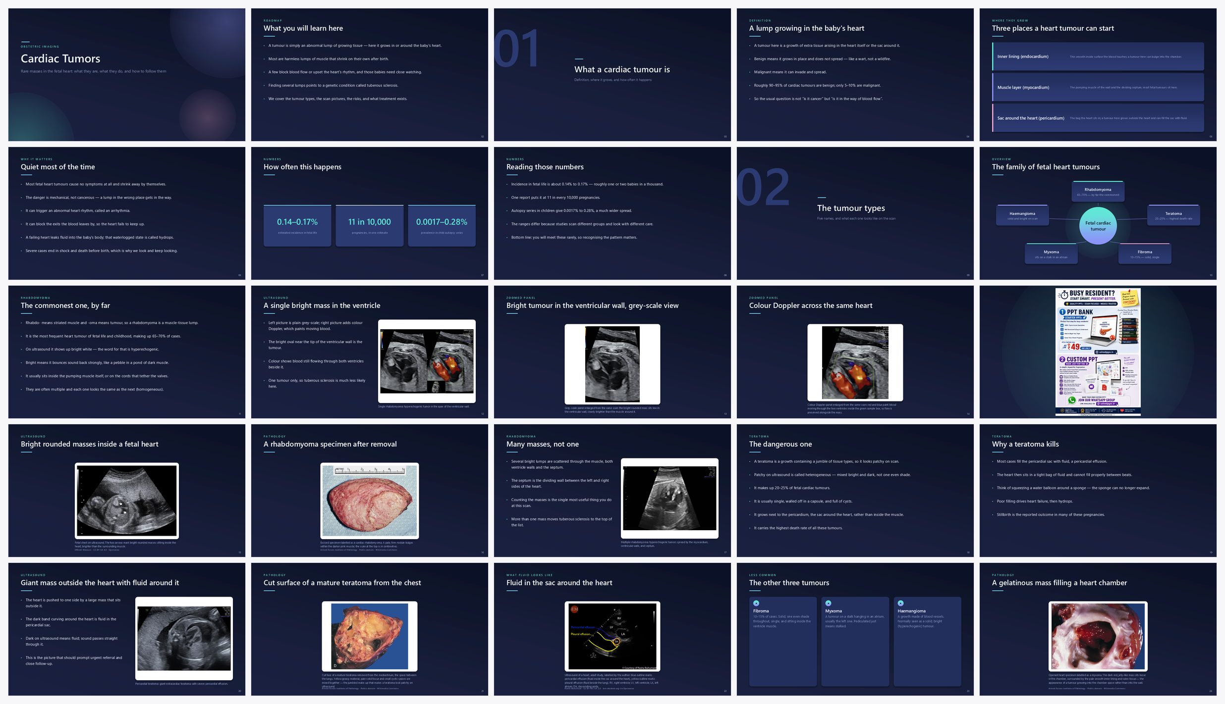 Preview of the first 25 slides of Cardiac Tumors
