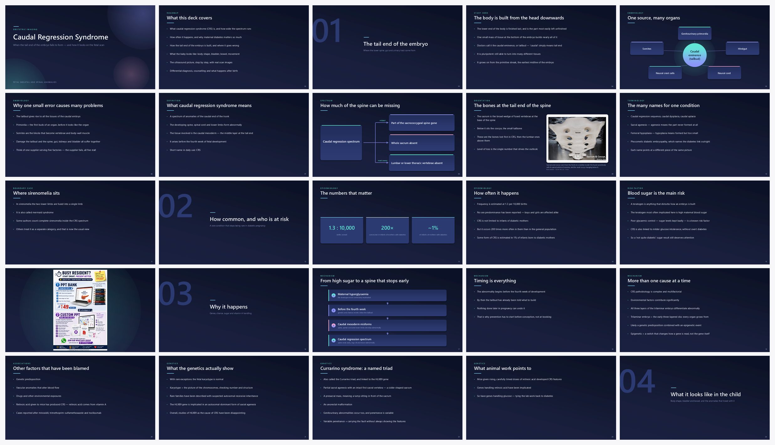 Preview of the first 25 slides of Caudal Regression Syndrome