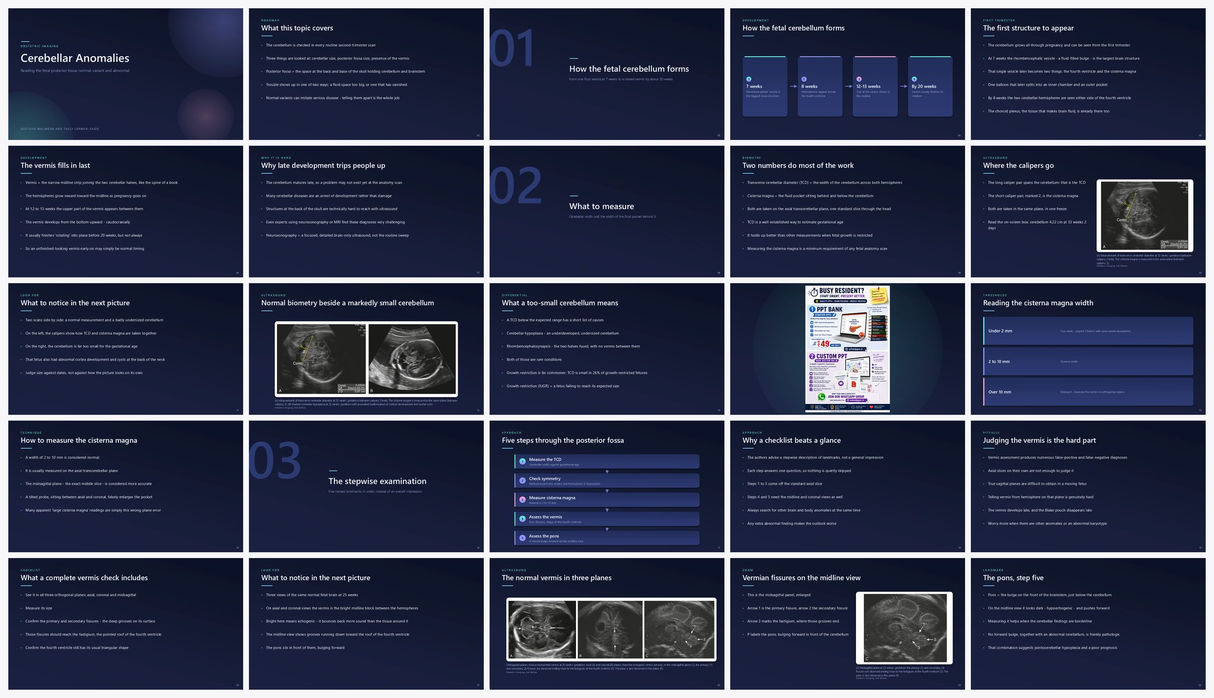 Preview of the first 25 slides of Cerebellar Anomalies