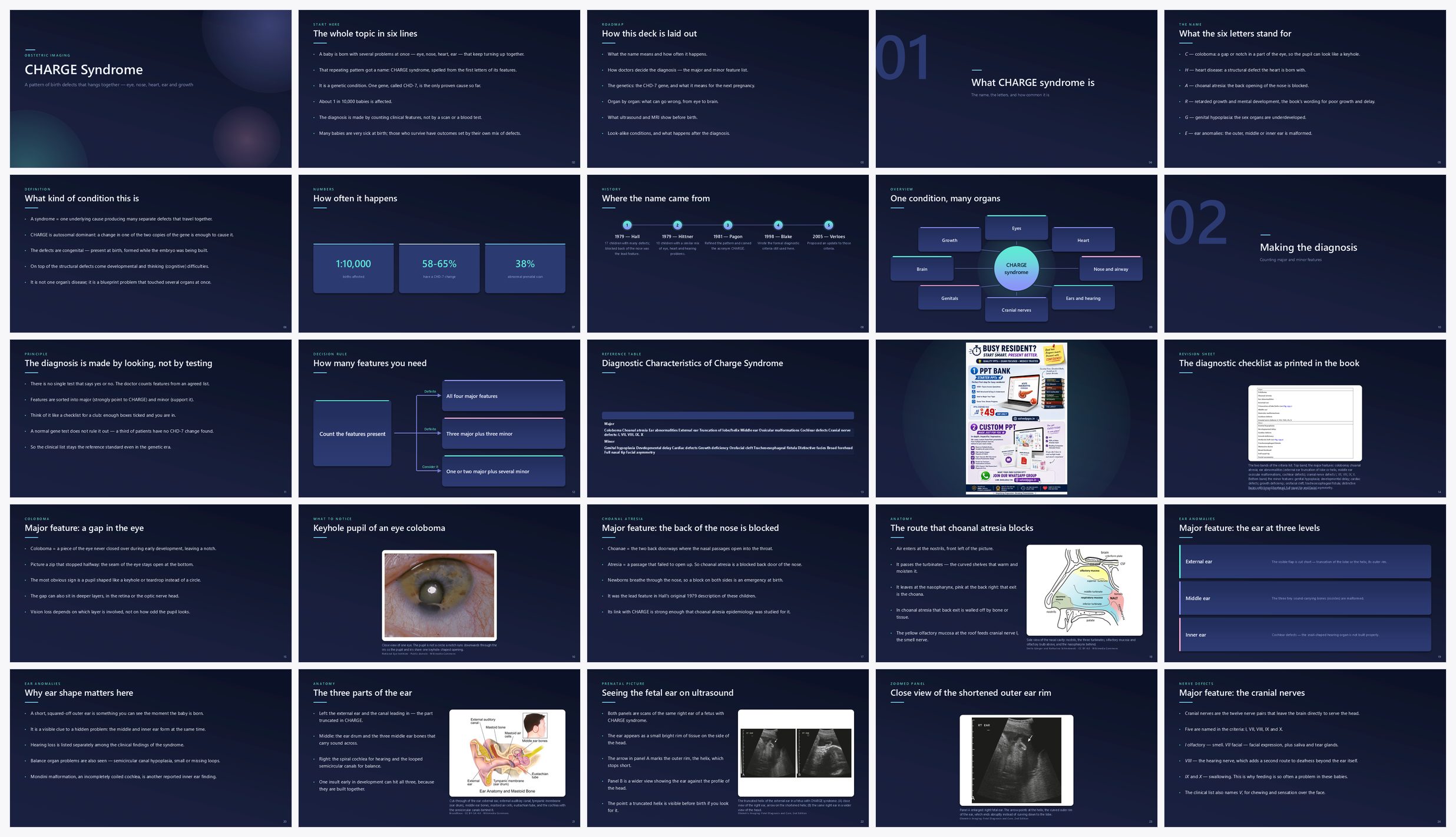 Preview of the first 25 slides of CHARGE Syndrome