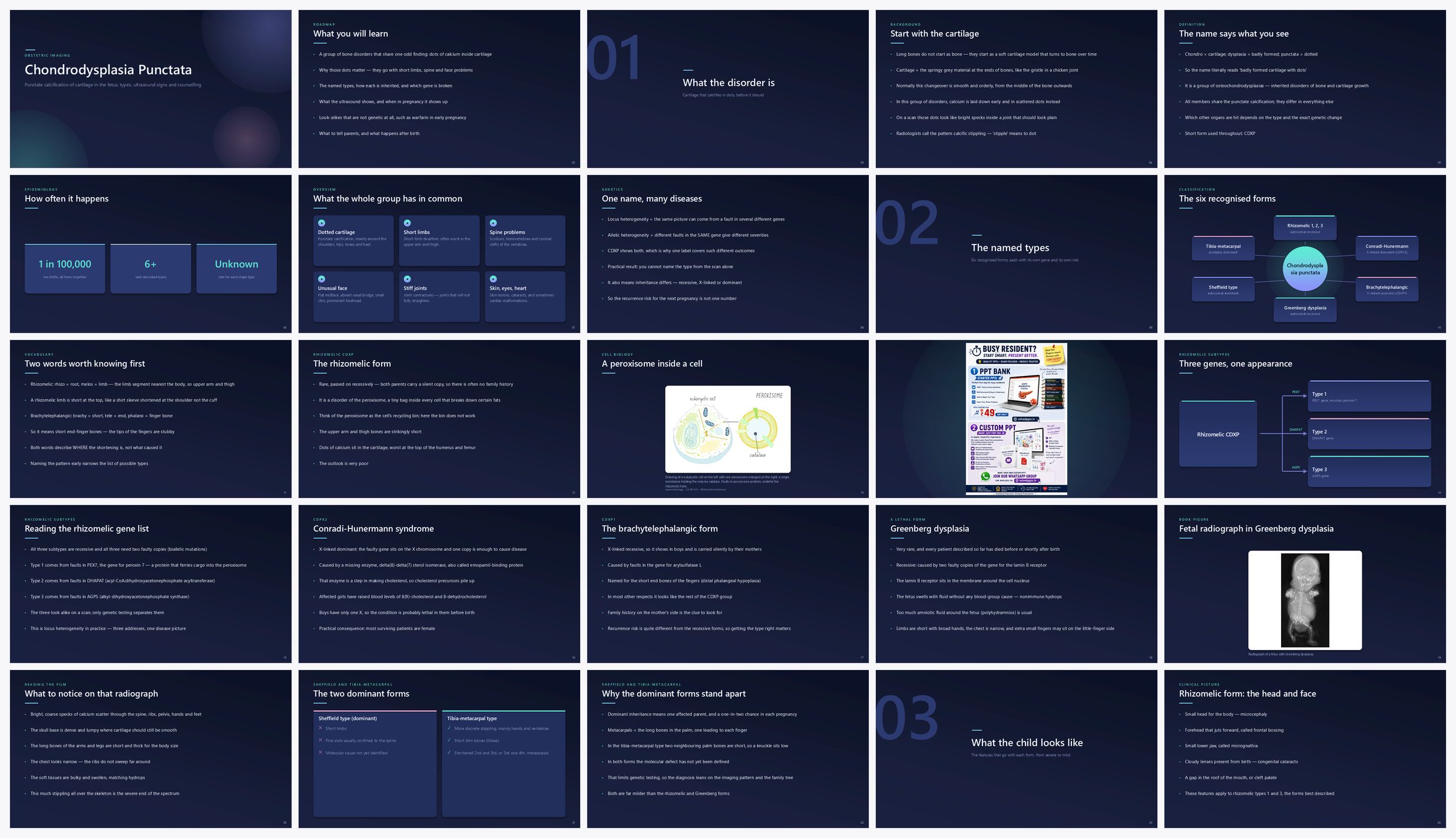 Preview of the first 25 slides of Chondrodysplasia Punctata