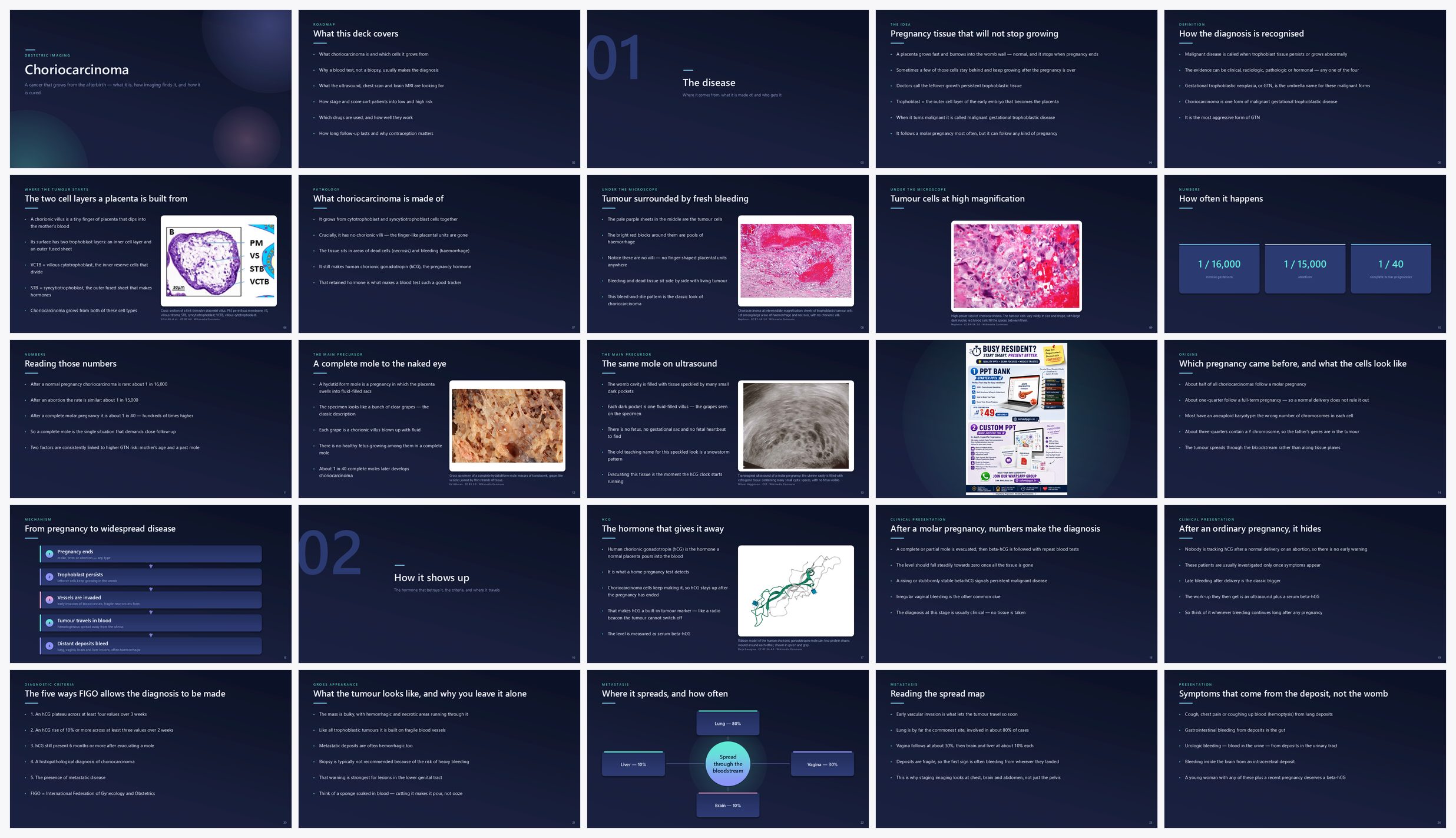 Preview of the first 25 slides of Choriocarcinoma