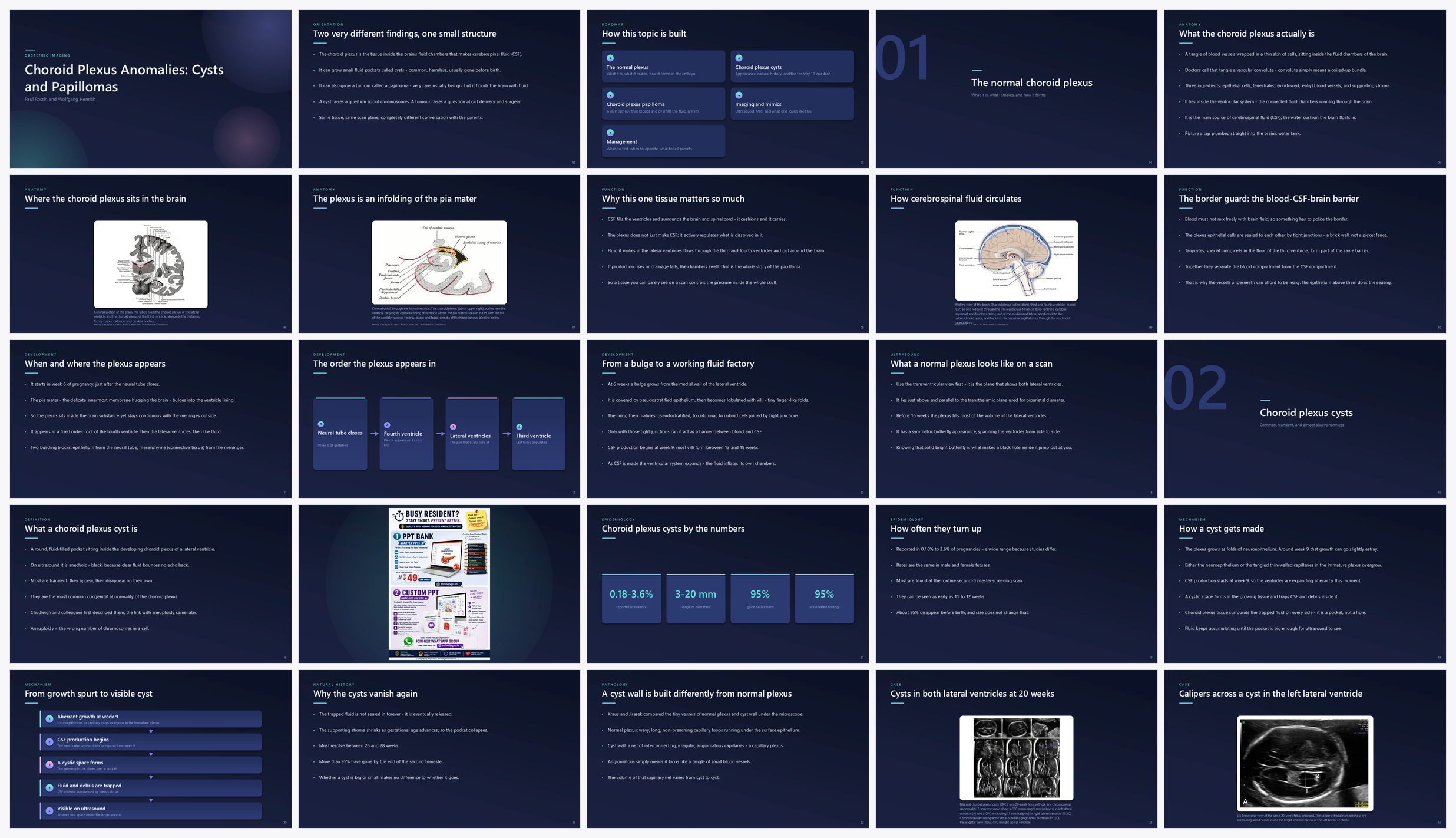 Preview of the first 25 slides of Choroid Plexus Anomalies Cysts and Papillomas