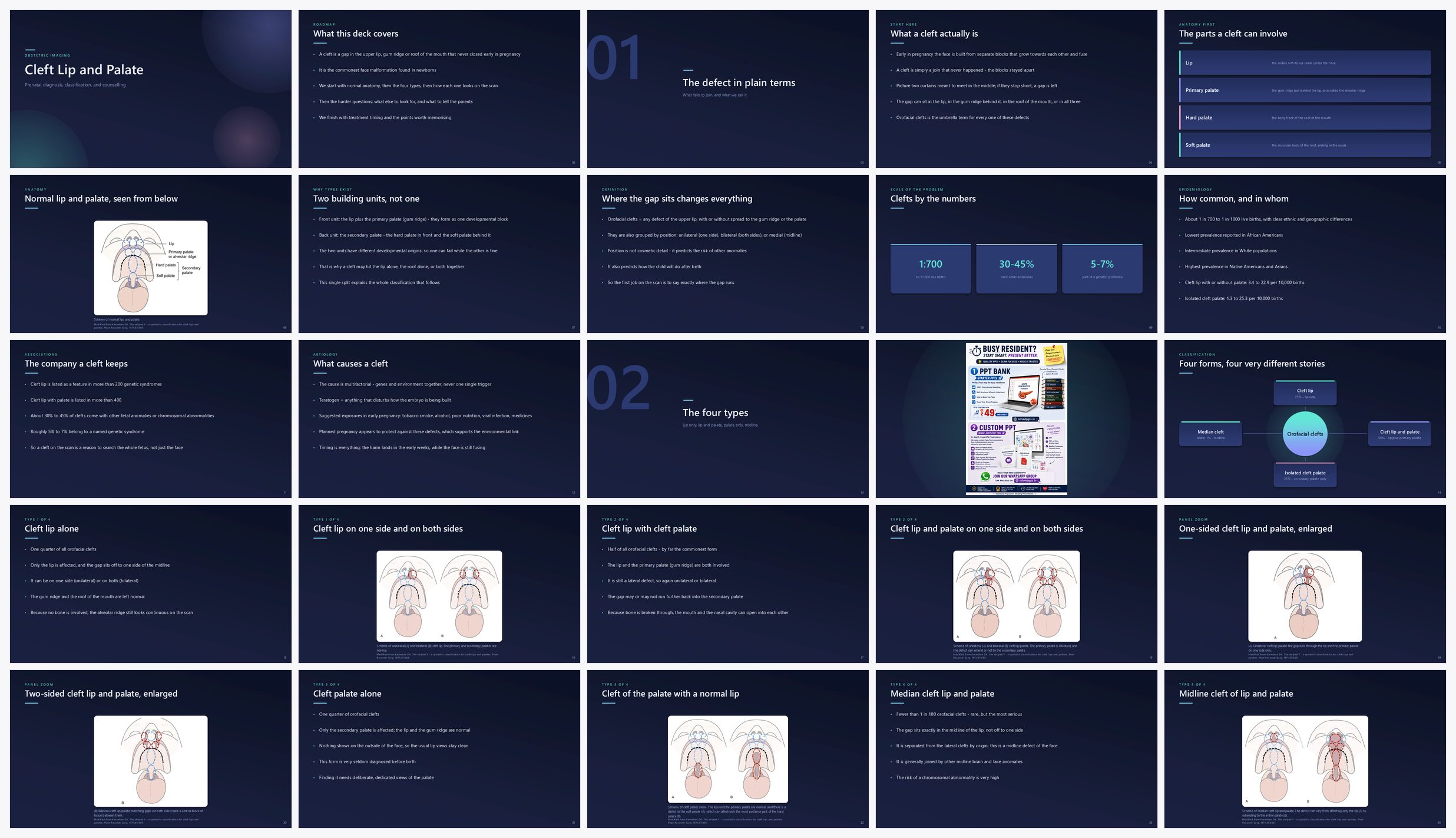 Preview of the first 25 slides of Cleft Lip and Palate