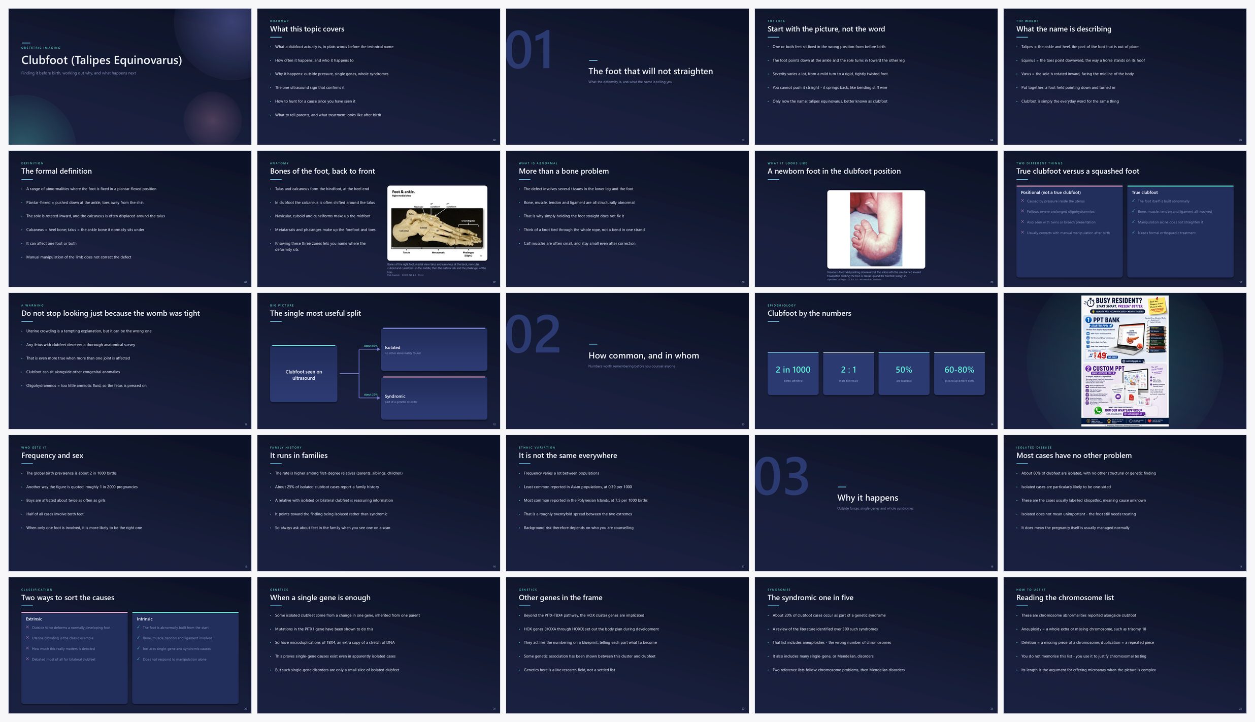 Preview of the first 25 slides of Clubfoot (Talipes Equinovarus)