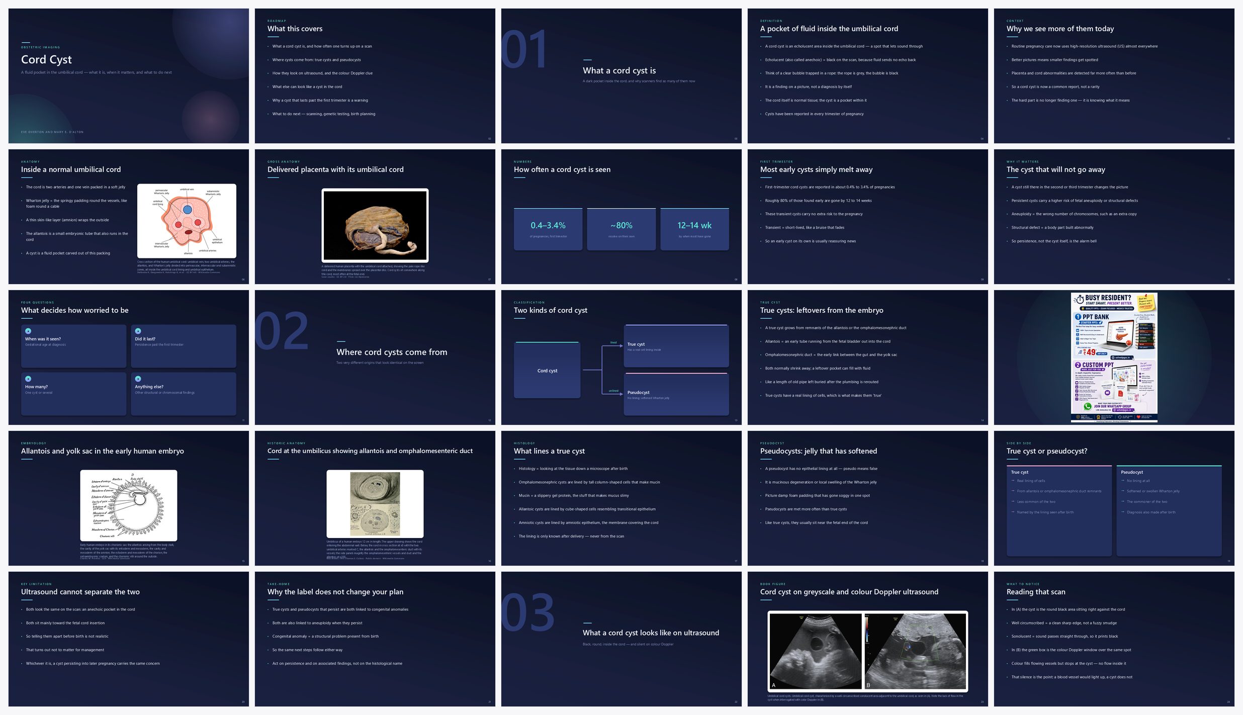 Preview of the first 25 slides of Cord Cyst