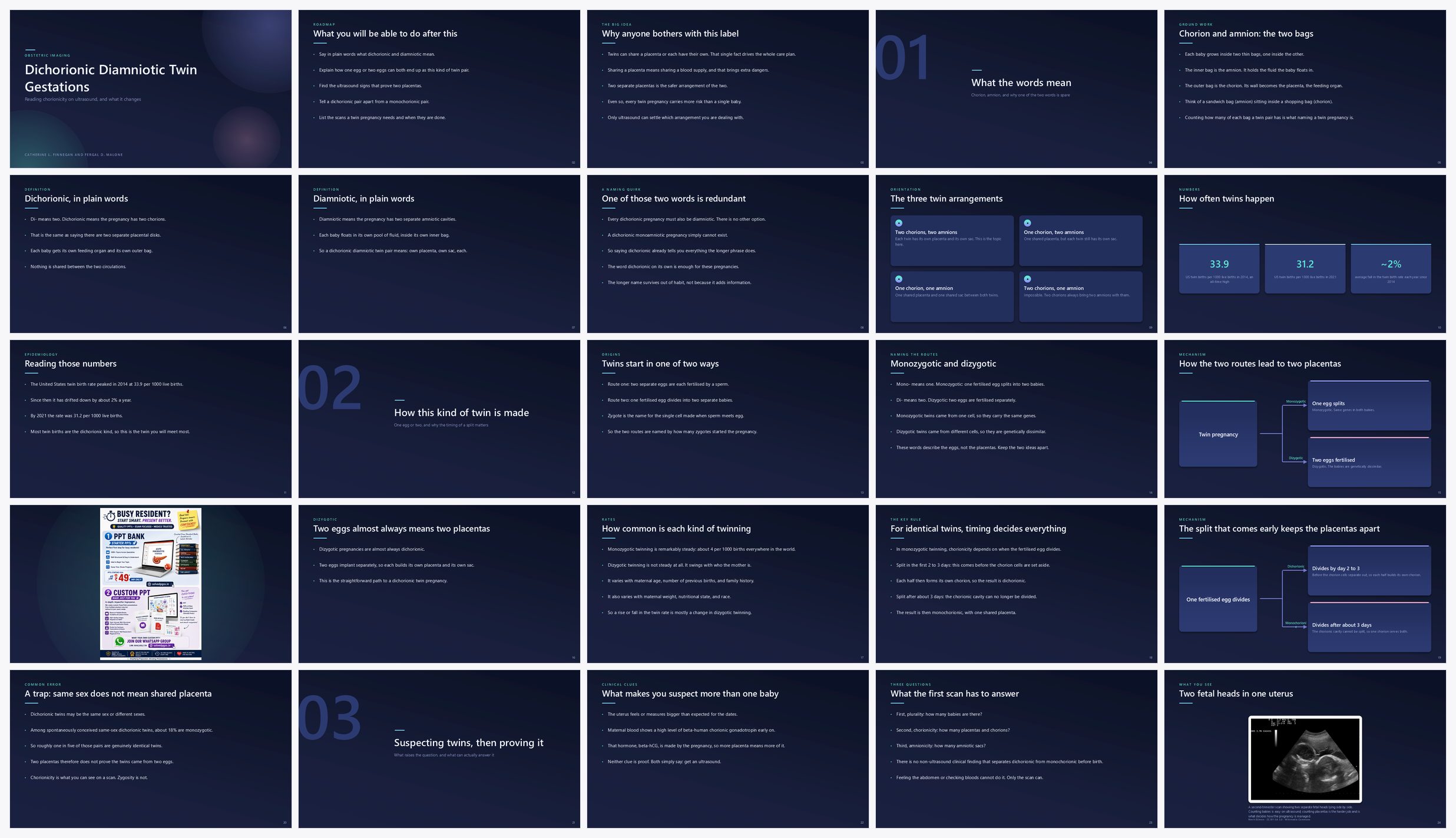 Preview of the first 25 slides of Dichorionic Diamniotic Twin Gestations