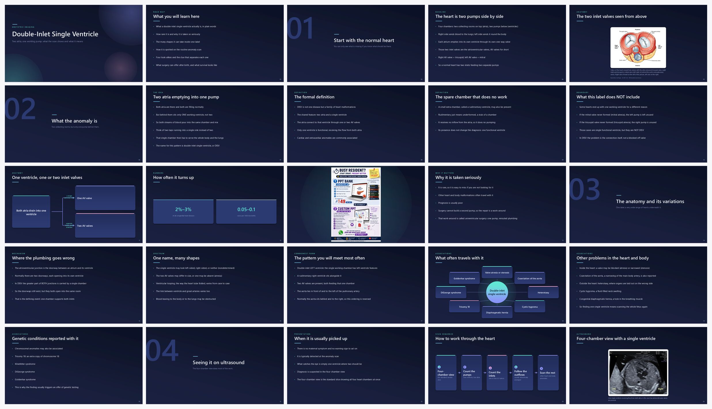Preview of the first 25 slides of Double-Inlet Single Ventricle
