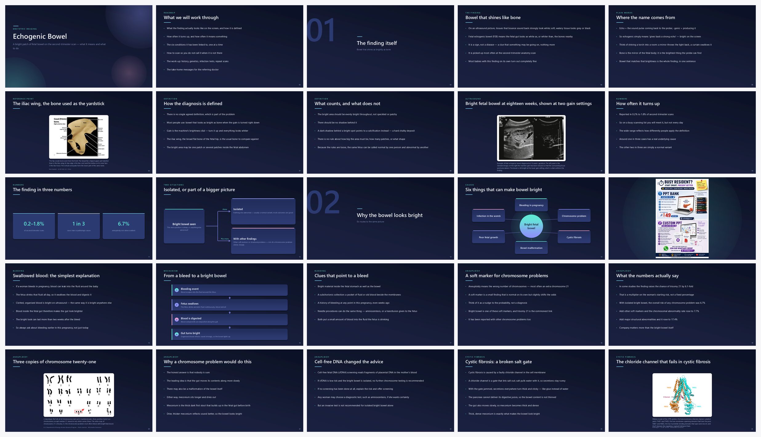 Preview of the first 25 slides of Echogenic Bowel