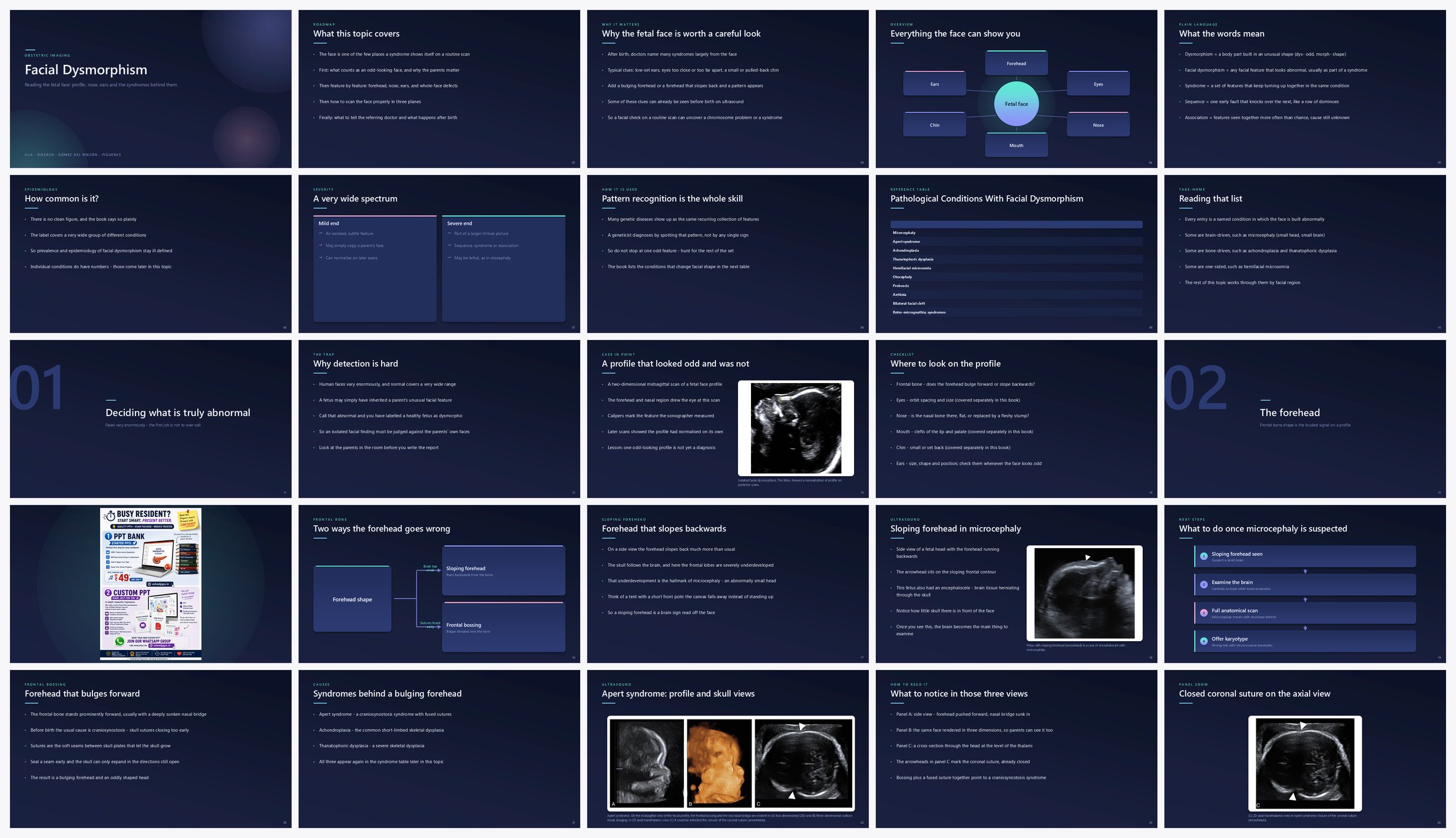 Preview of the first 25 slides of Facial Dysmorphism