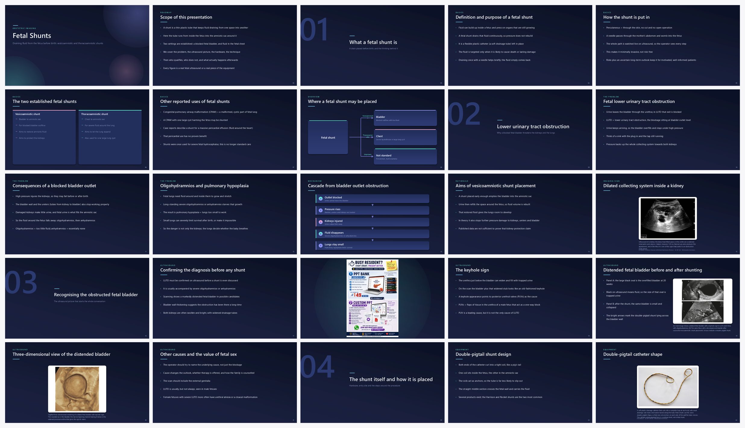 Preview of the first 25 slides of Fetal Shunts