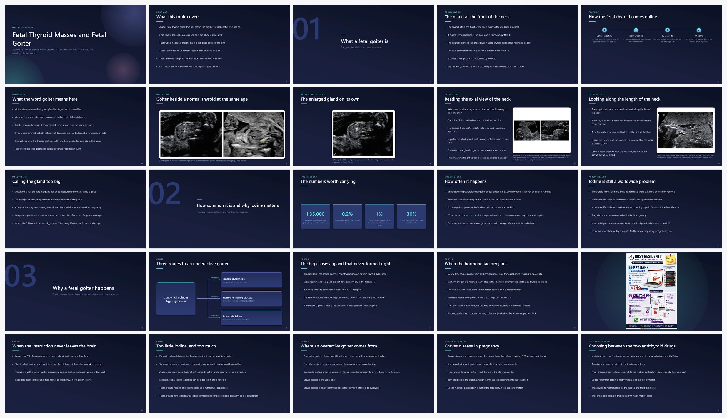 Preview of the first 25 slides of Fetal Thyroid Masses and Fetal Goiter