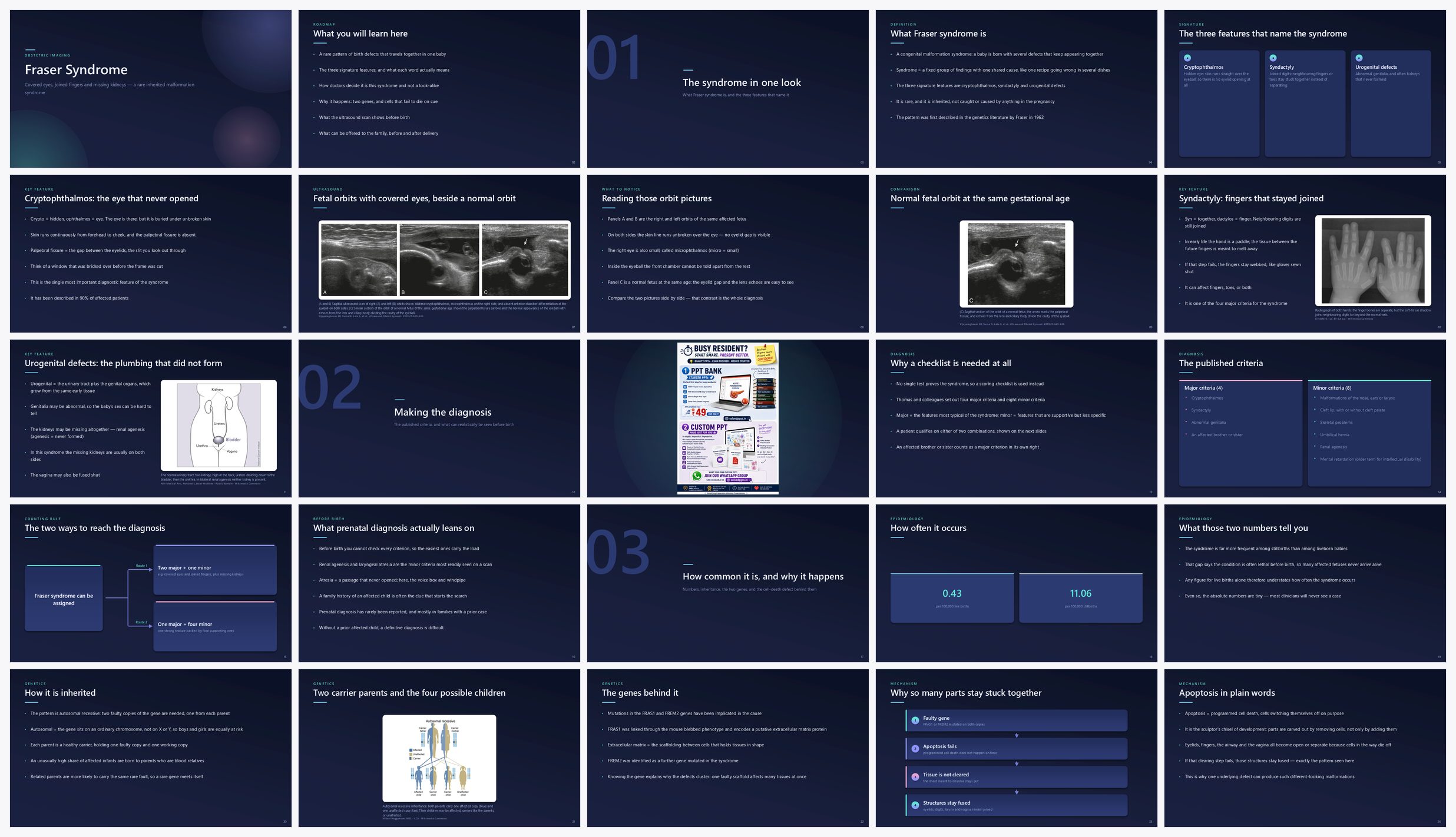 Preview of the first 25 slides of Fraser Syndrome